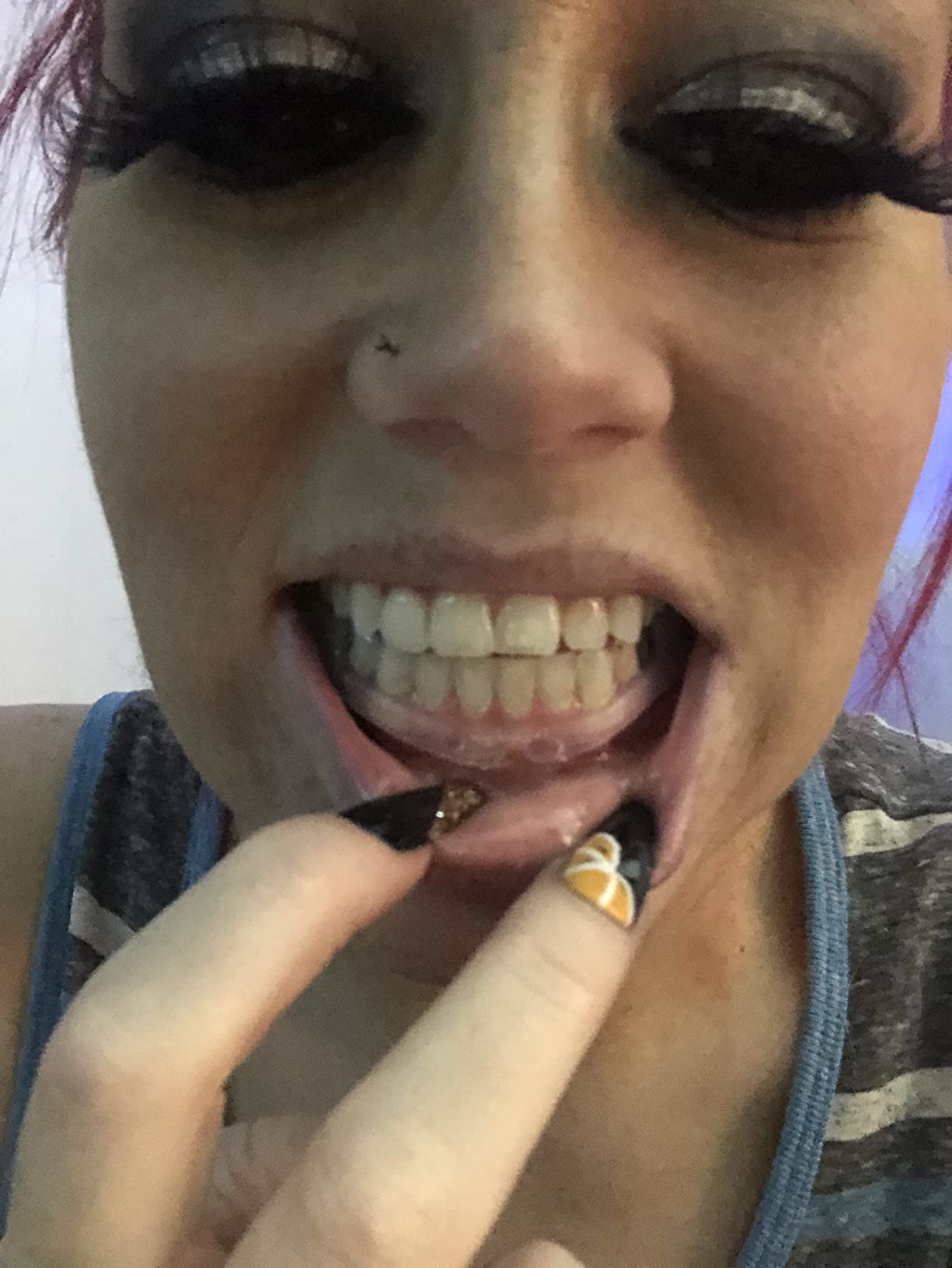 Plackers Grind No More Night Guard, Nighttime Protection for Teeth, Sleep Well, BPA Free, Ready to Wear, Disposable, One Size Fits All, 10 Count customer photo 2