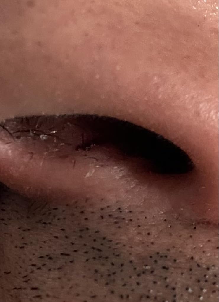 Air Max Nasal Dilators Trial Pack - Anti Snoring Devices - 76% More Airflow for Better Breathing & Against Nasal Congestion - Guaranteed Fit (1x Small & 1x Medium) - Reusable customer photo 1