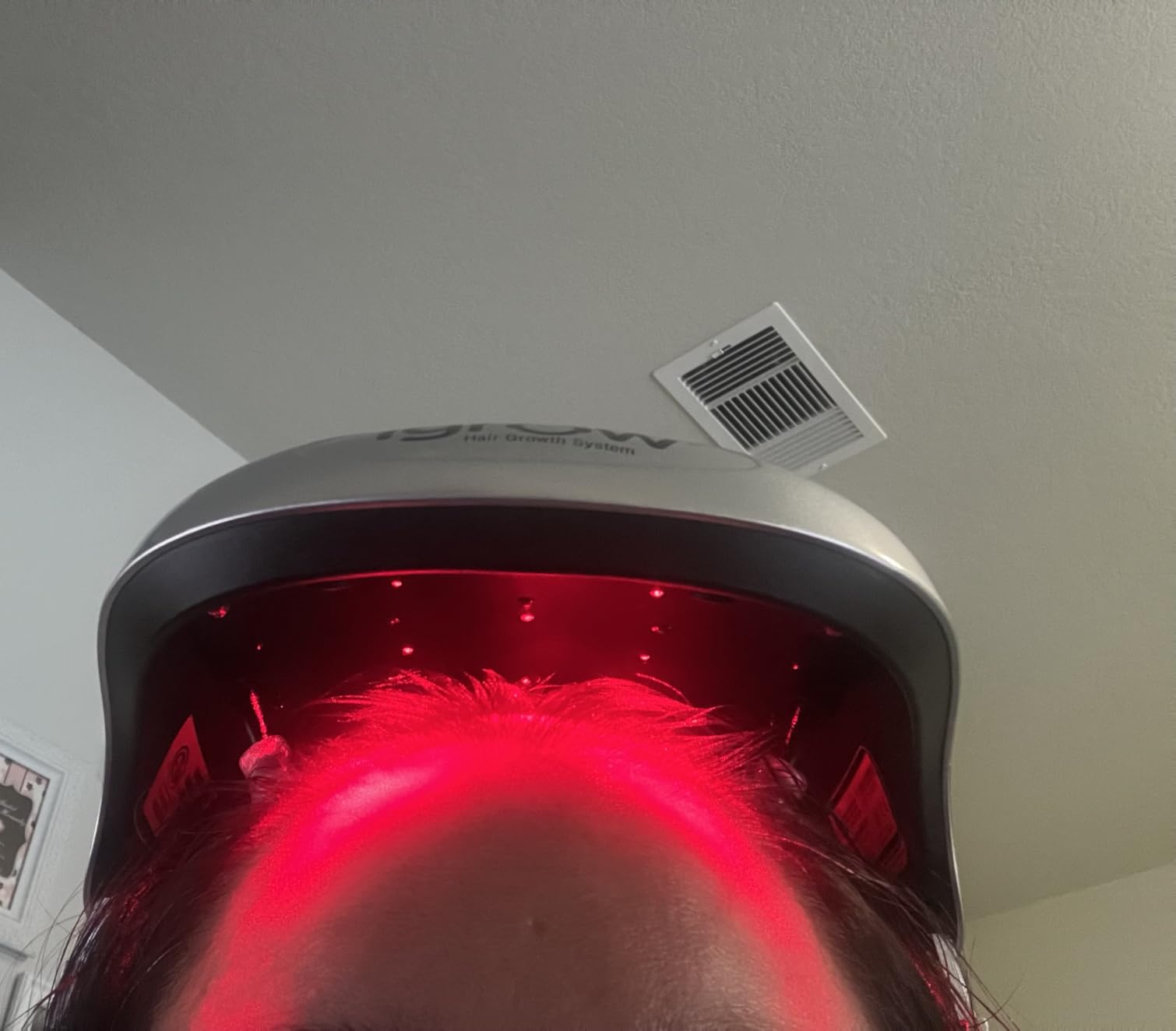 iGrow Laser Hair Growth System - Red Light Therapy, Clinically Proven, FDA Cleared Laser Cap Hair Growth for Men & Women customer photo 2