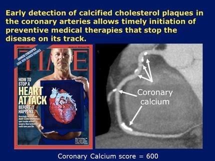 Air Relax AR-2 Professional Compression Boots, FDA Cleared Leg Recovery System, Medical Grade Recovery Boots and Pump, 3 Therapy Modes 4 Chambers, for Circulation in Legs and Muscle Relief customer photo 2