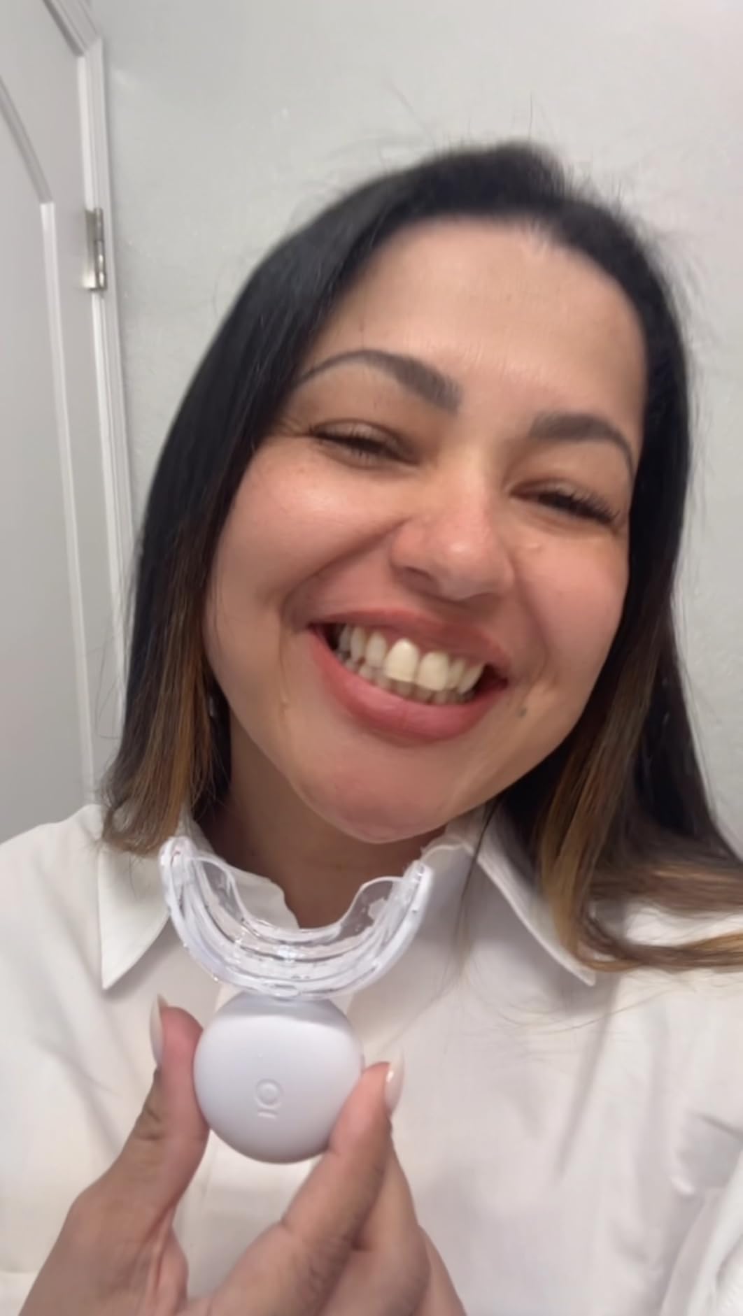 Auraglow Teeth Whitening Kit, LED Accelerator Light, 35% Carbamide Peroxide Teeth Whitening Gel, 20+ Whitening Treatments, Whitens up to 10 Shades in 7 Days customer photo 2