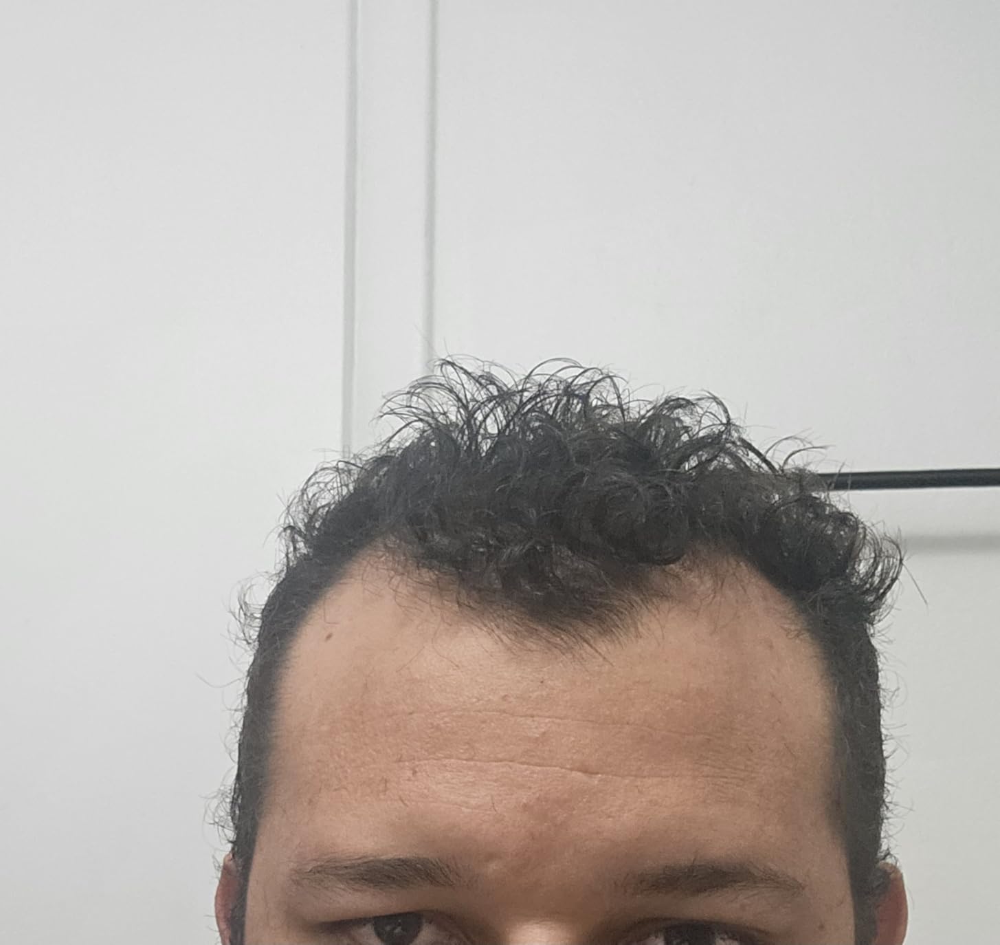 iRestore Essential - Laser Red Light Therapy for Hair Growth - FDA Cleared Hair Loss, Hair Thinning & Alopecia Treatment for Men & Women customer photo 2