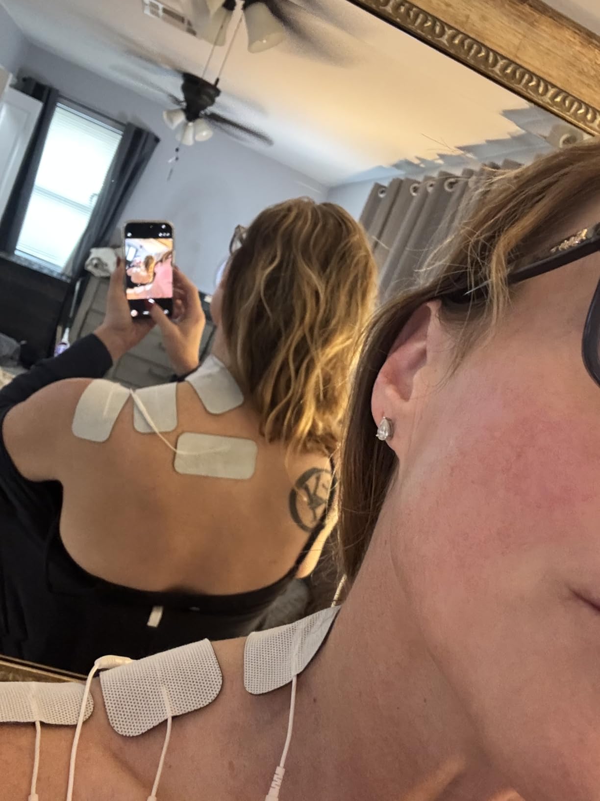 AUVON Dual Channel TENS Unit Muscle Stimulator Machine with 20 Modes, 2 inch and 2 inchx4 inch TENS Unit Electrode Pads customer photo 1