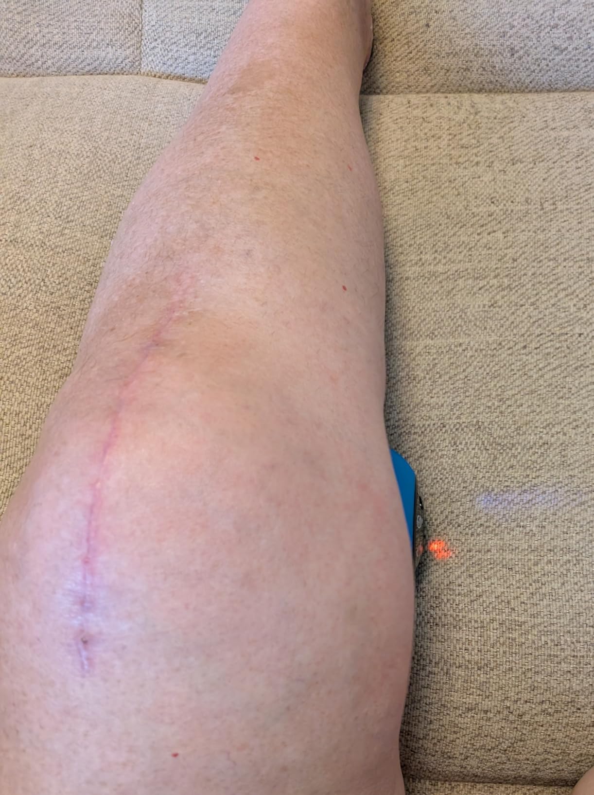 Rolling With It Vibrating Peanut Massage Ball - Deep Tissue Trigger Point Therapy, Myofascial Release - Handheld, Cordless - 4 Intensity Levels - Dual Lacrosse Ball Vibration Massager customer photo 1