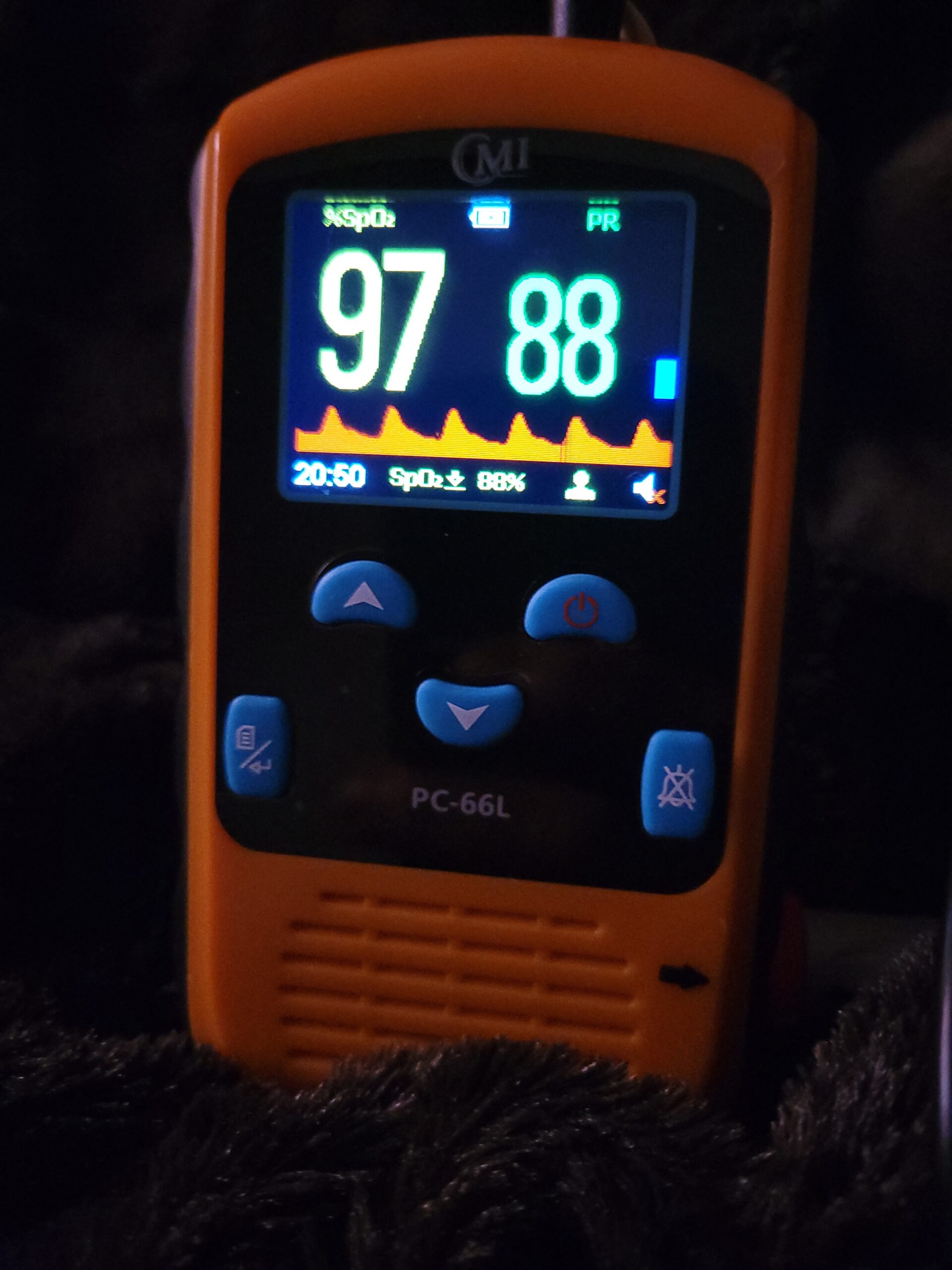 CMI Health Rechargeable Pulse Oximeter - Adult Finger Sensor for Continuous Monitoring & Spot-Checking - Adjustable Alarm for Pulse Rate and SpO2 Levels - Carry Case, AC Adapter Included customer photo 1