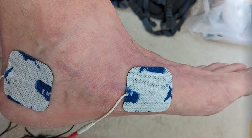 Roscoe Medical TENS Unit and EMS Muscle Stimulator, Twin Stim, OTC TENS Machine for Lower Back Pain Relief, Neck Pain, or Sciatica Relief, Clinical Strength Stim Machine customer photo 1