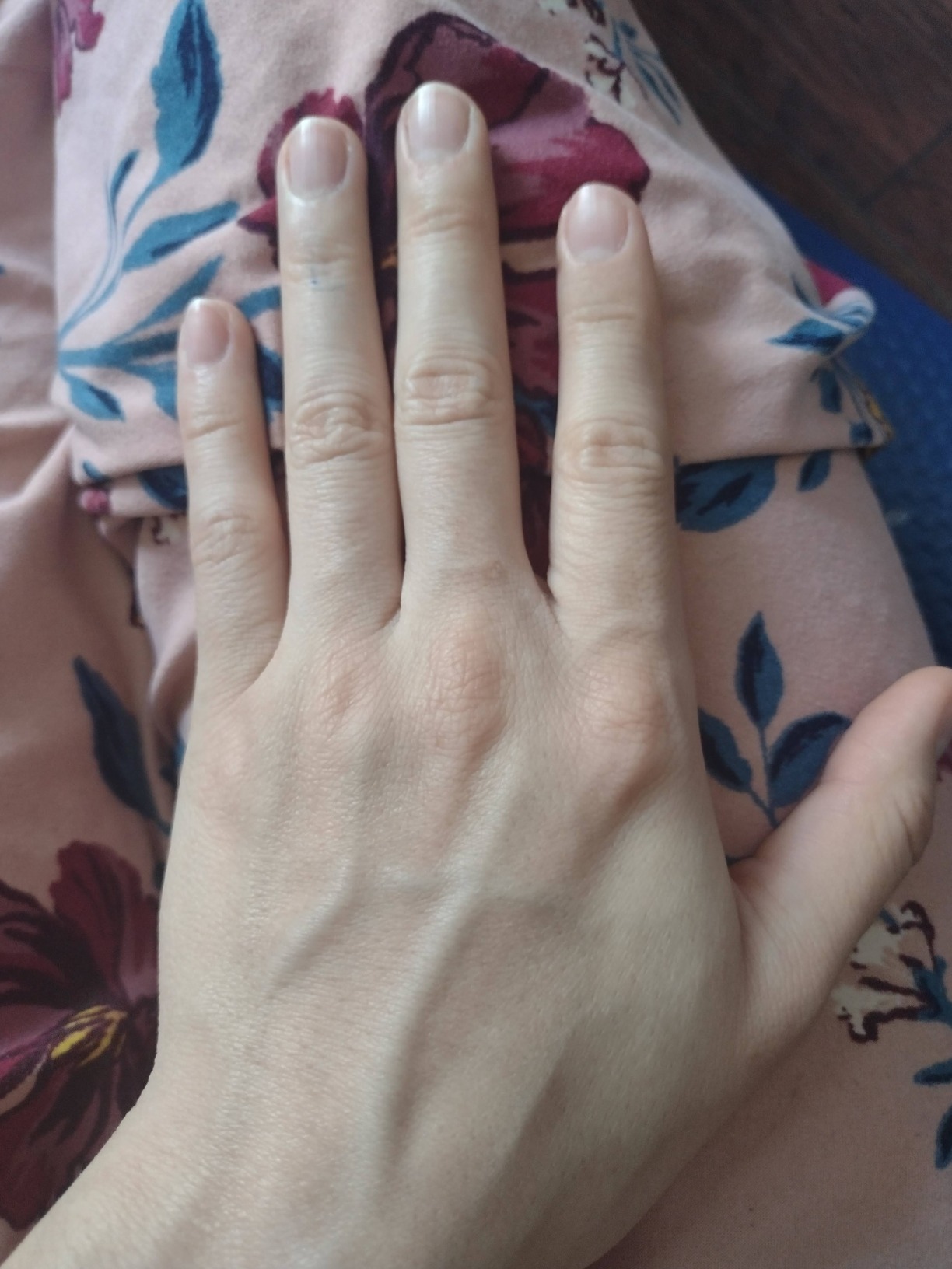 XSOUL At-Home IPL Hair Removal for Women and Men Permanent Hair Removal 999,999 Flashes Painless Hair Remover on Armpits Back Legs Arms Face Bikini Line, Corded customer photo 1