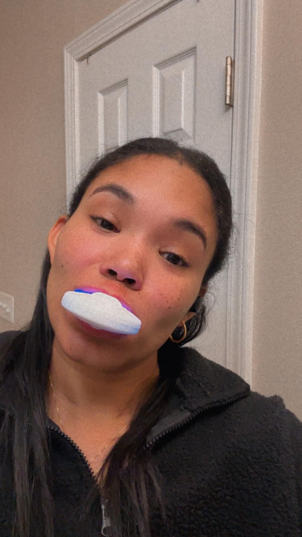 MySmile Teeth Whitening Kit with LED Light, 10 Min Non-Sensitive Fast Teeth Whitener with 3 Carbamide Peroxide Whitening Gel, Helps to Remove Stains from Coffee, Smoking, Wines, Soda, Food customer photo 2