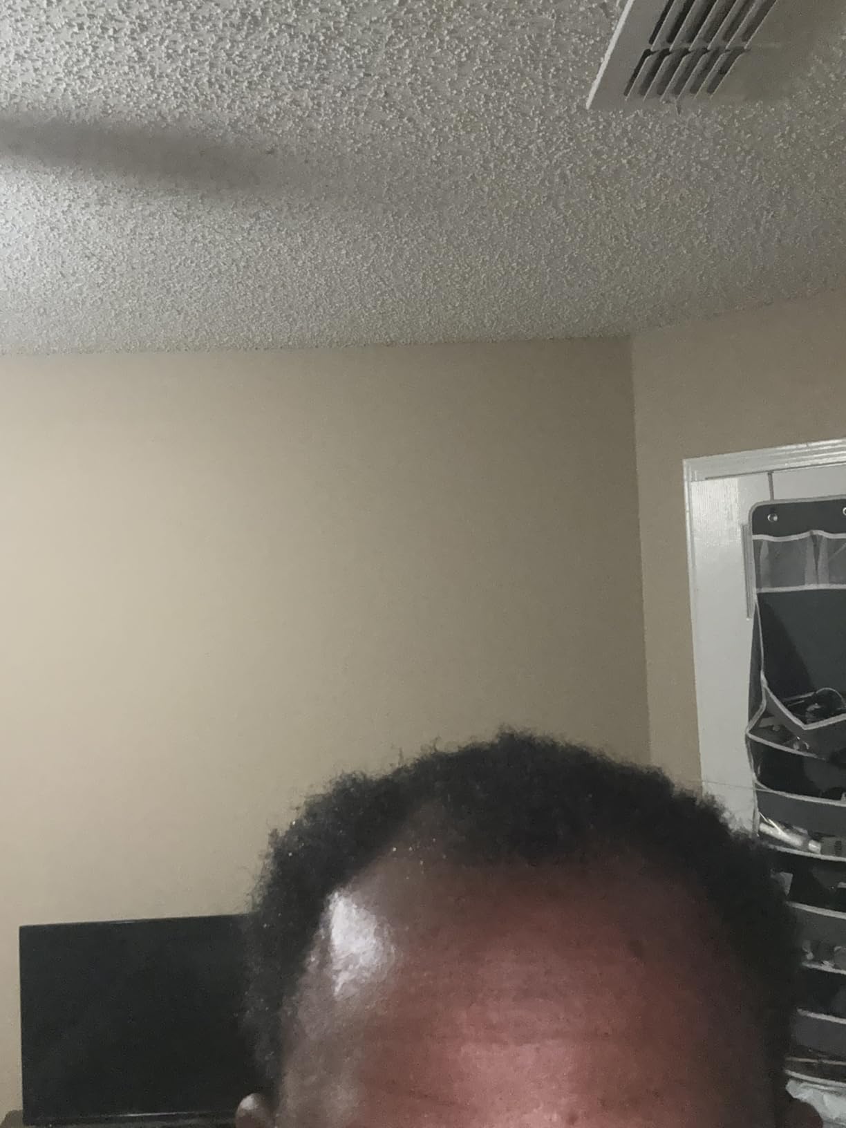 Koi Beauty Derma Roller Titanium Microneedle Roller, 540 Microneedling Roller for Men Women Face Scalp, Beard Roller for Men, Premium Micro Needling Roller Matte Black customer photo 1