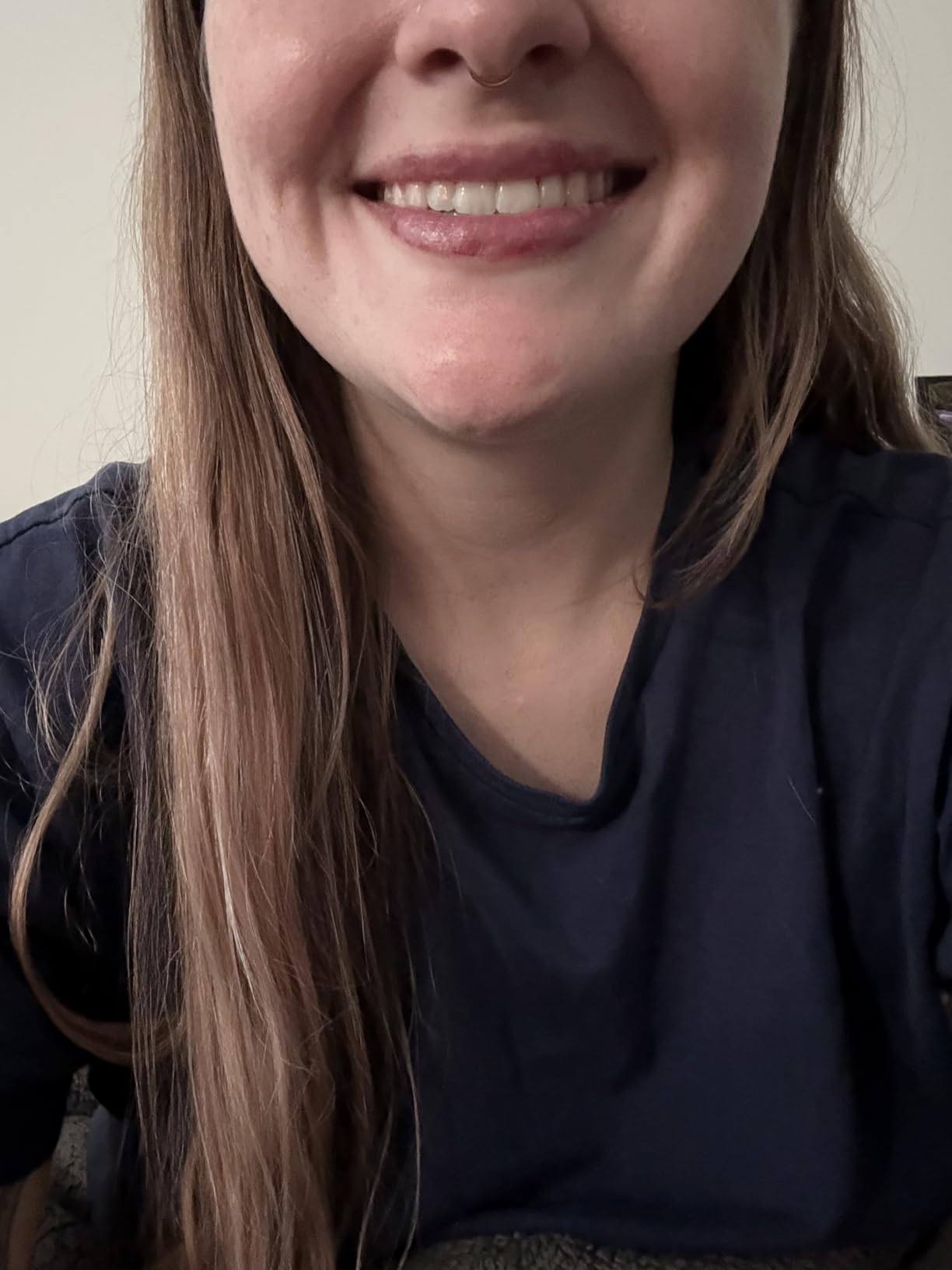 Crest 3D Whitestrips Professional Effects + LED Light - Teeth Whitening Kit, 1 Light + 20 Treatments, Each with 1 Upper/1Lower, 40 Strips - Crest 3DWhite Teeth Whitening Strips customer photo 1