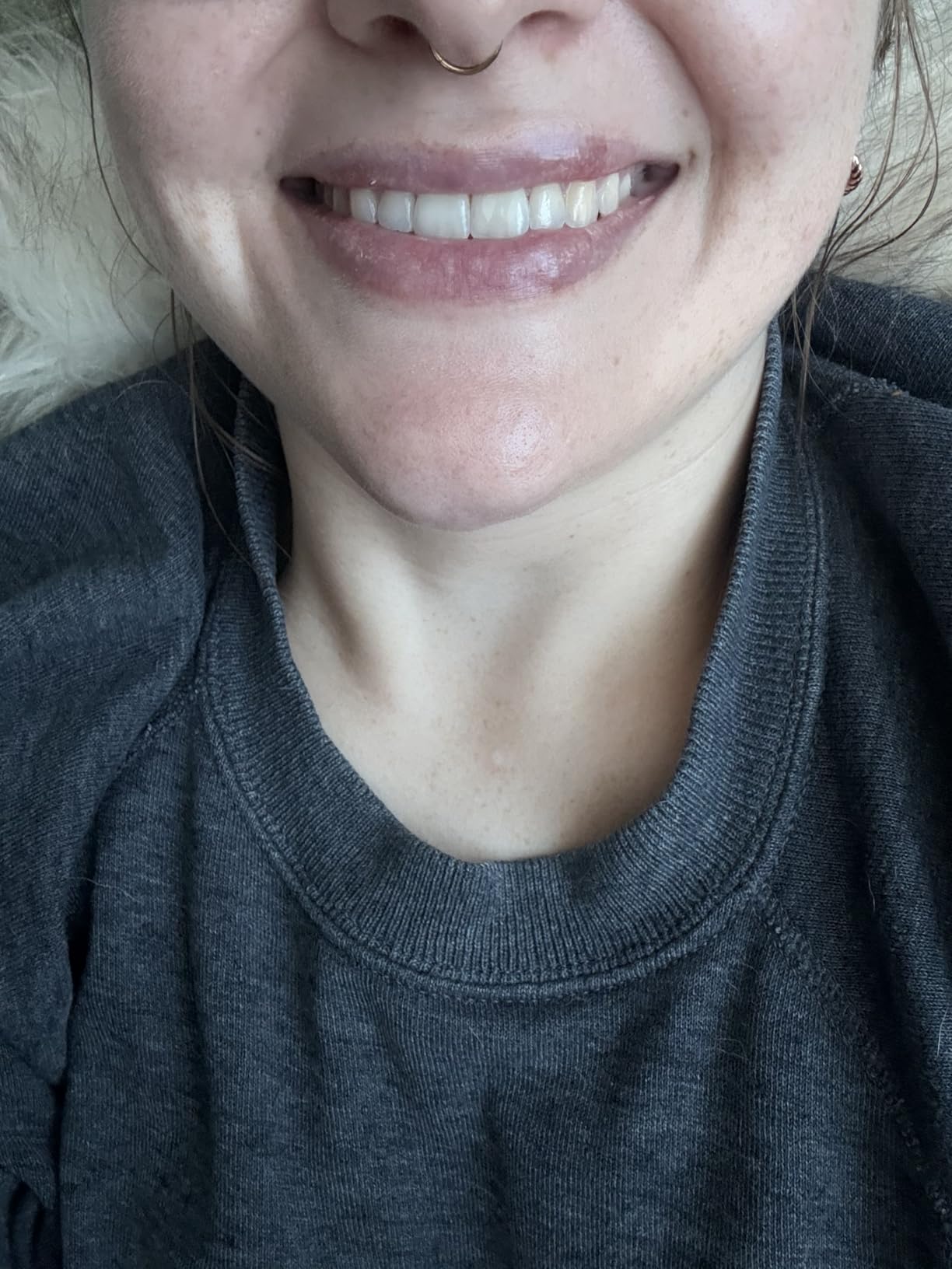 Crest 3D Whitestrips Professional Effects + LED Light - Teeth Whitening Kit, 1 Light + 20 Treatments, Each with 1 Upper/1Lower, 40 Strips - Crest 3DWhite Teeth Whitening Strips customer photo 2