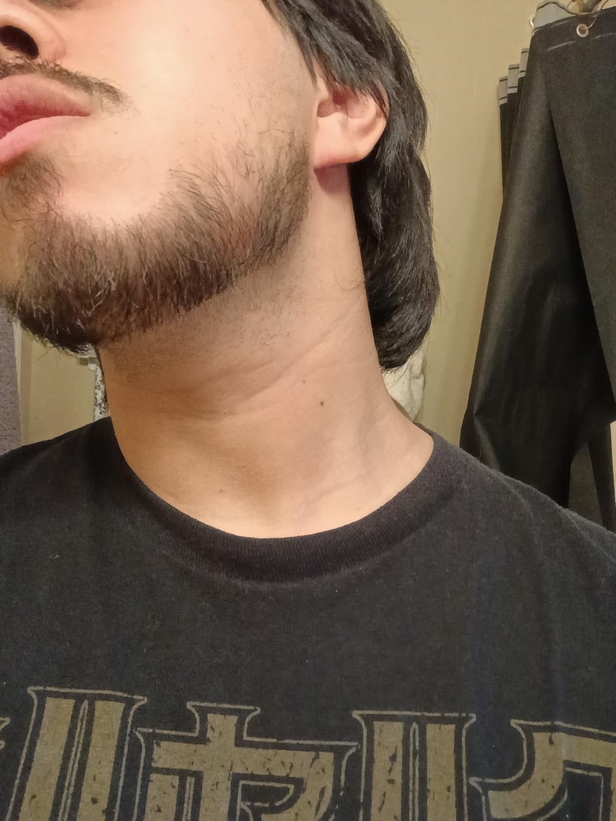 MANSCAPED The Beard Hedger Men's Premium Beard Trimmer, 20 Length Adjustable Blade Wheel, Stainless Steel T-Blade for Precision Facial Hair Trimming, Cordless Waterproof Wet/Dry Clipper customer photo 1