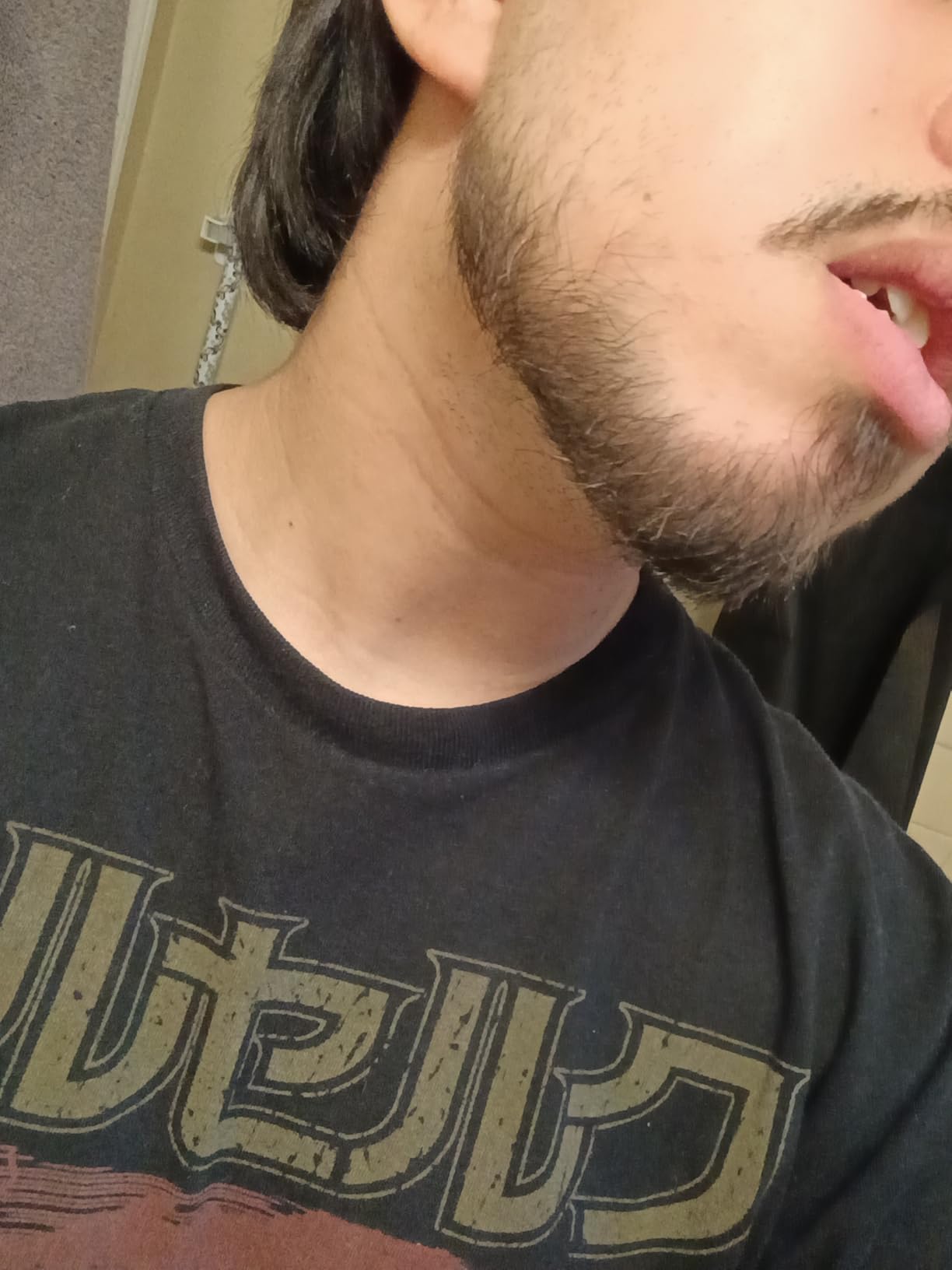 MANSCAPED The Beard Hedger Men's Premium Beard Trimmer, 20 Length Adjustable Blade Wheel, Stainless Steel T-Blade for Precision Facial Hair Trimming, Cordless Waterproof Wet/Dry Clipper customer photo 2