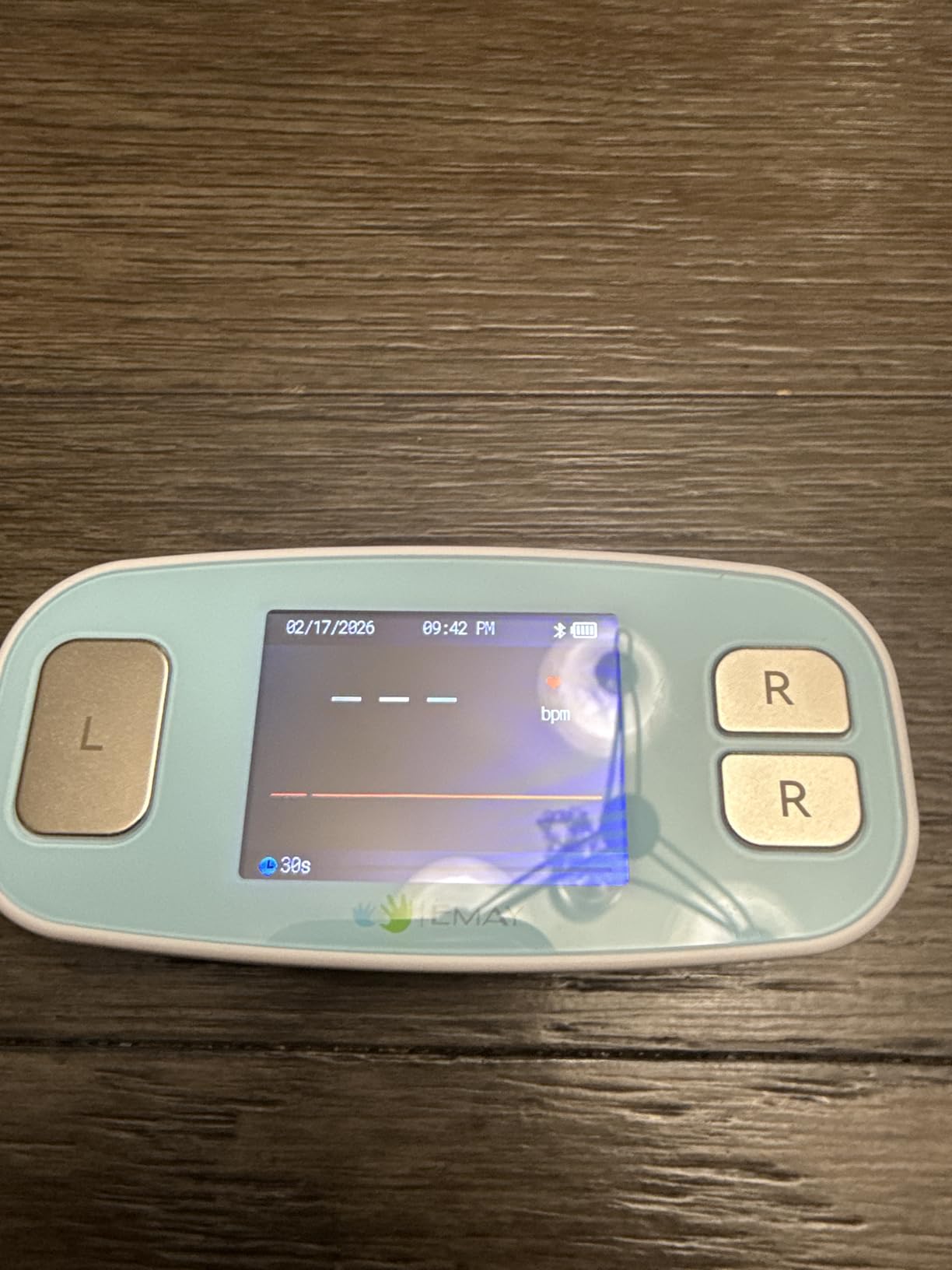 EMAY 6L Portable ECG Monitor | Record ECG and Heart Rate in 6 Channels | Compatible with Smartphone and PC | No Subscription Required customer photo 2