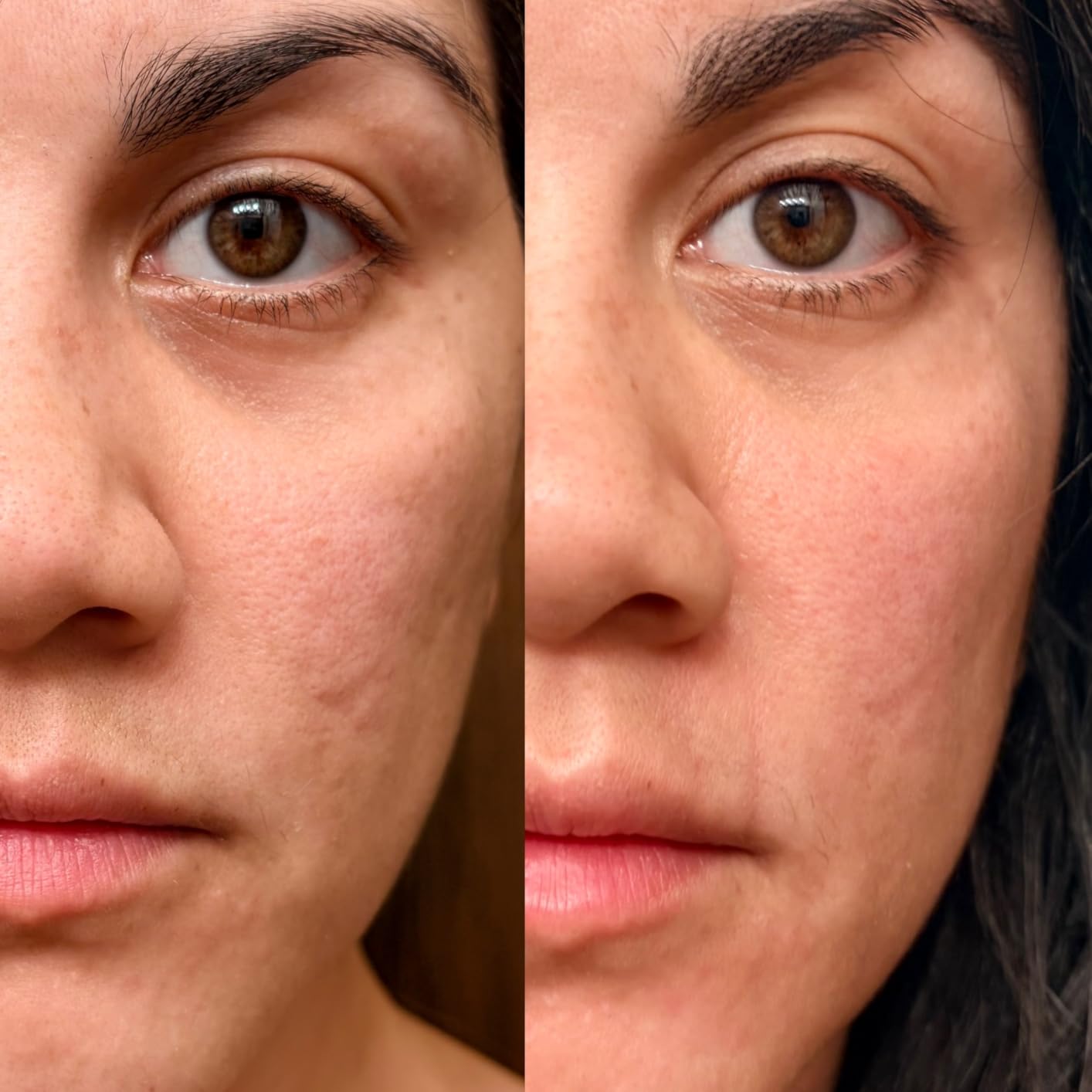 LifePro Red Light Therapy for Body Panel - 90 & 120 Dual Chip LEDs - 660nm & 850nm Near Infrared Full Body Red light Therapy Panel - For Daily Wellness & Comfort customer photo 1