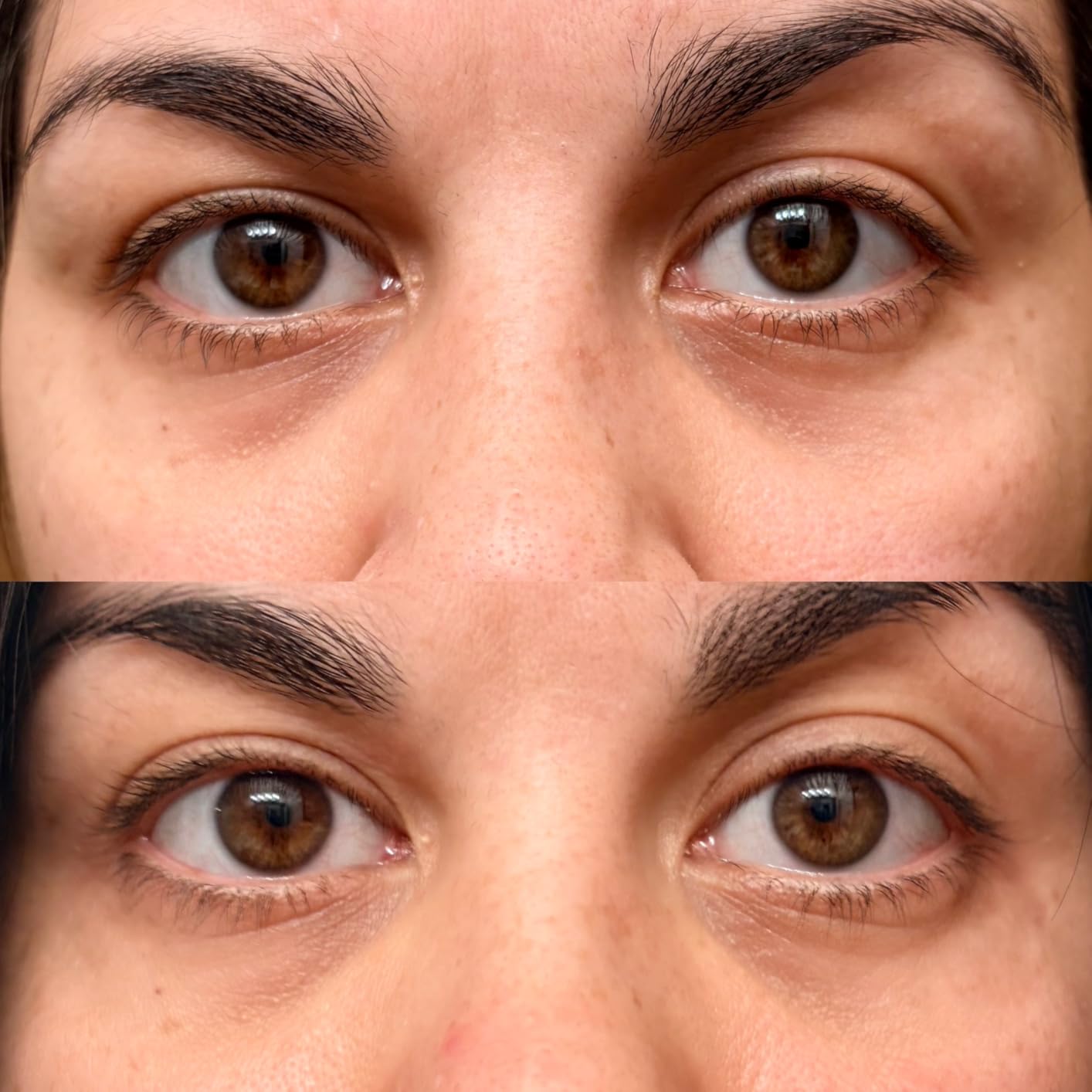 LifePro Red Light Therapy for Body Panel - 90 & 120 Dual Chip LEDs - 660nm & 850nm Near Infrared Full Body Red light Therapy Panel - For Daily Wellness & Comfort customer photo 2