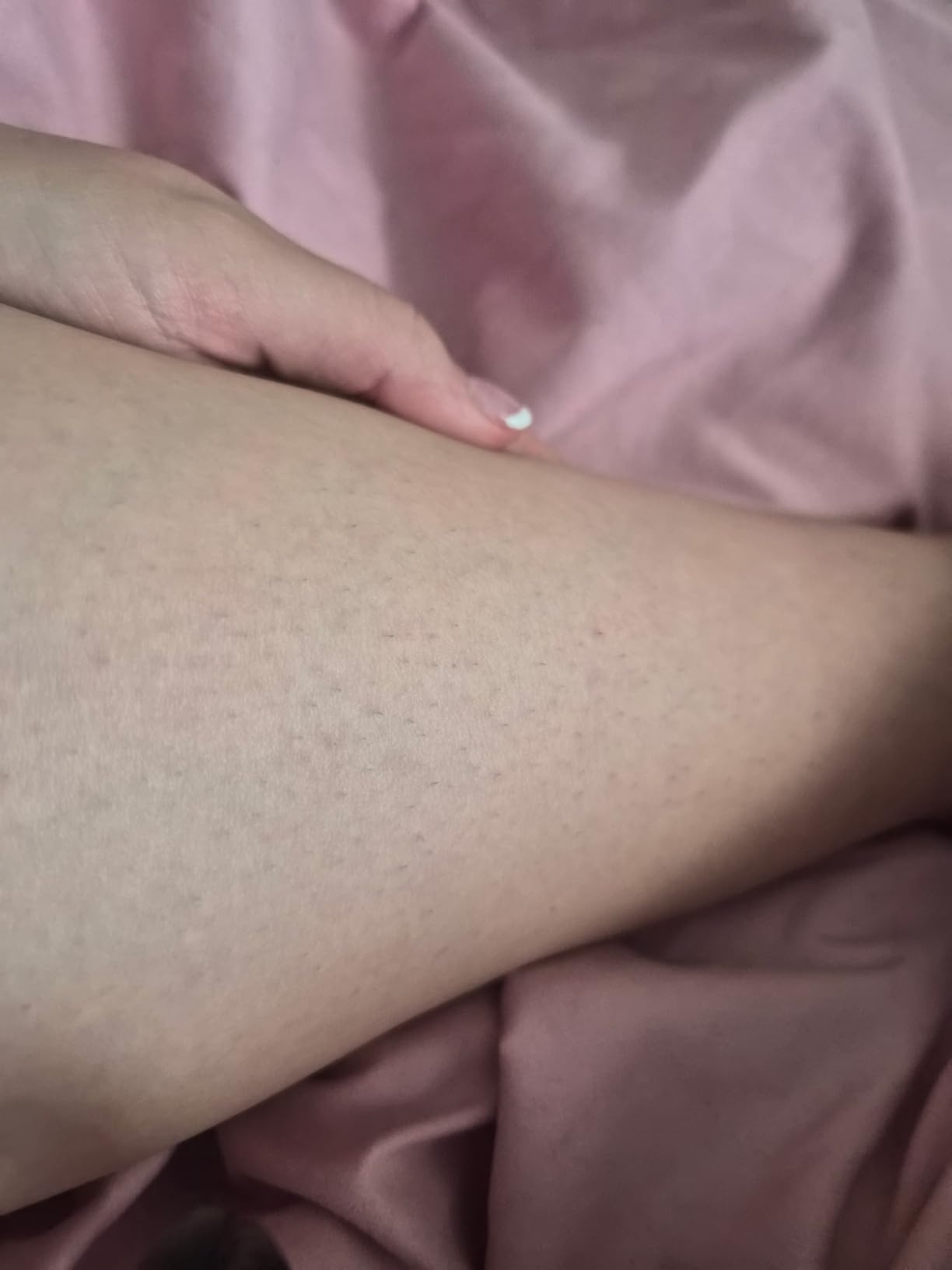 BoSidin IPL Hair Removal with Painless Ice-Cooling, 2-in-1 Face SR Rejuvenation, 6+1 Modes, 6 Levels Hair Removal for Women Permanent, Laser Hair Removal Kit with Shaver, Goggles customer photo 1