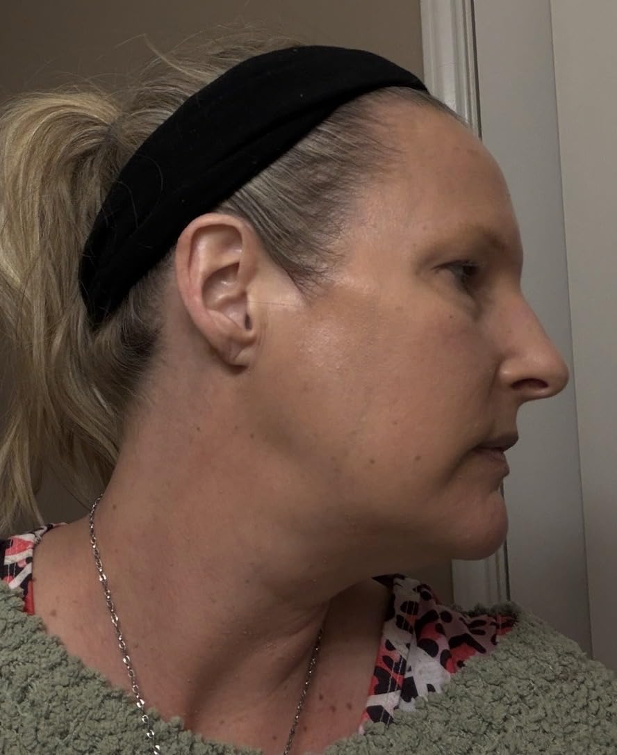 INIA 3-in-1 Red Light Therapy for Face and Neck Beauty Device for Puffiness & Skin Firming Skincare Tool (White) customer photo 1