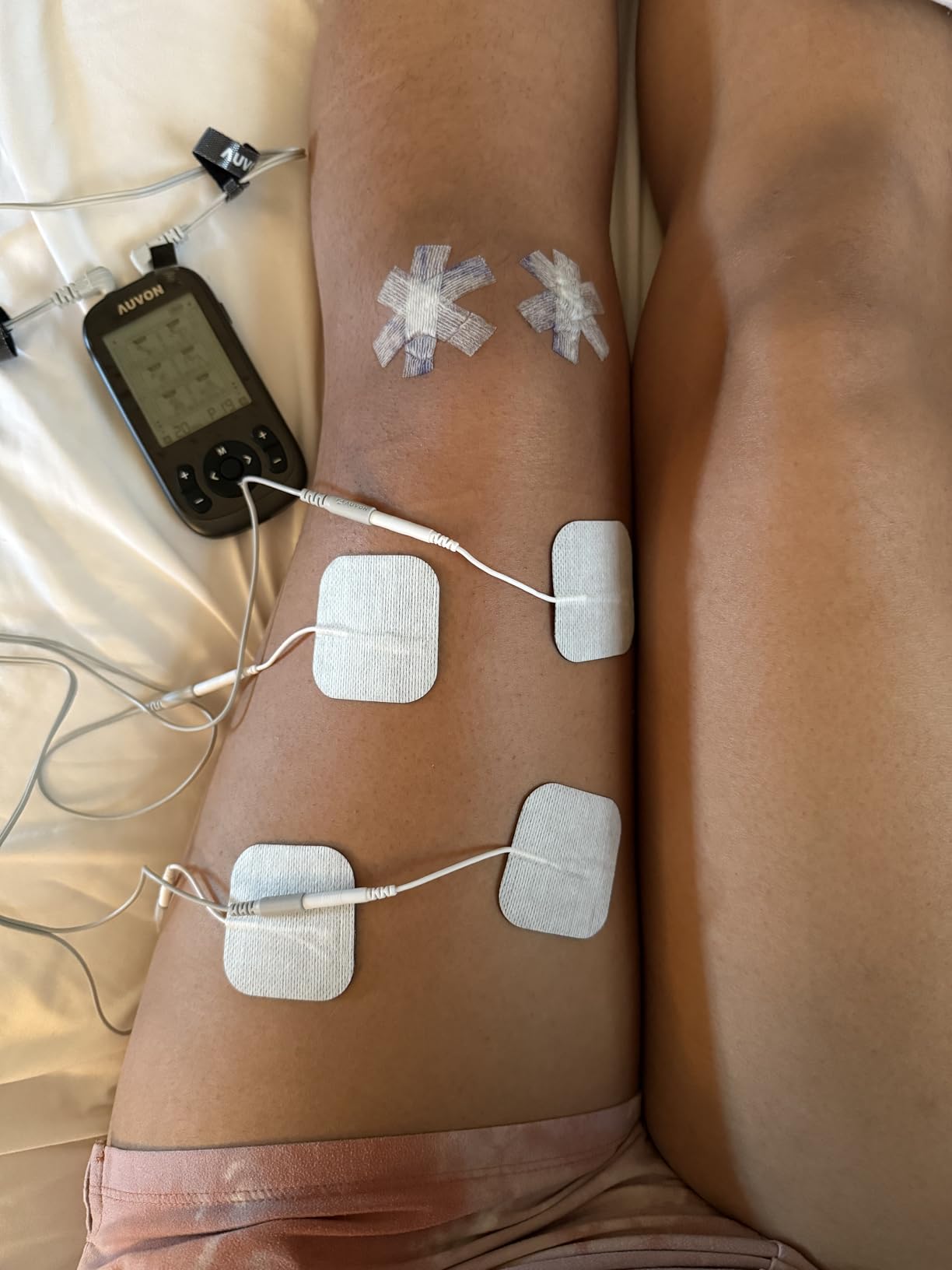 AUVON 3-in-1 TENS Unit Muscle Stimulator, EMS Massage Machine with 40 Intensities for Gradual Shoulder, Sciatica, Back Pain Relief, 24 Modes Rechargeable Electronic Pulse Massager with 12 TENS Pads customer photo 2