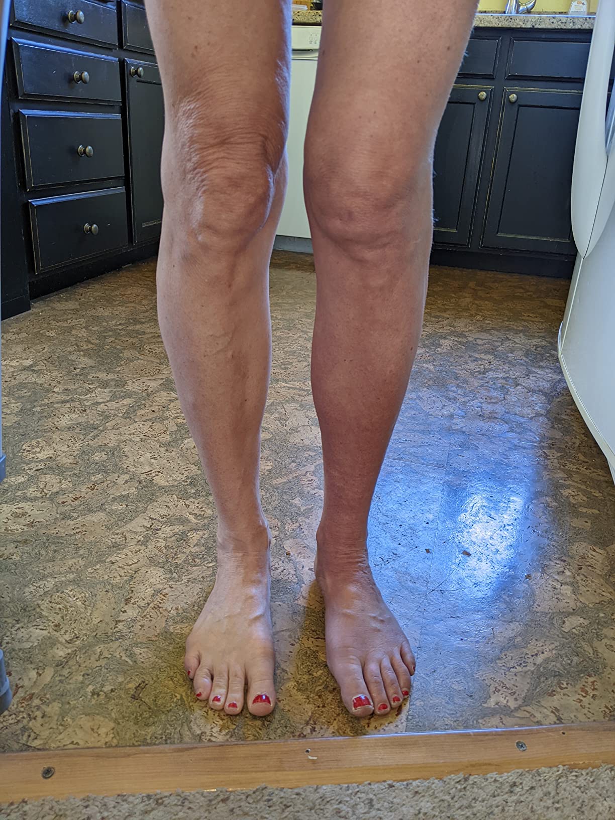 Therabody JetBoots Prime - Ultra-Portable, Wireless Compression Boots for Easy Leg Muscle Recovery - Calf, Leg & Thigh Compression Sleeve with Customizable Treatments customer photo 1