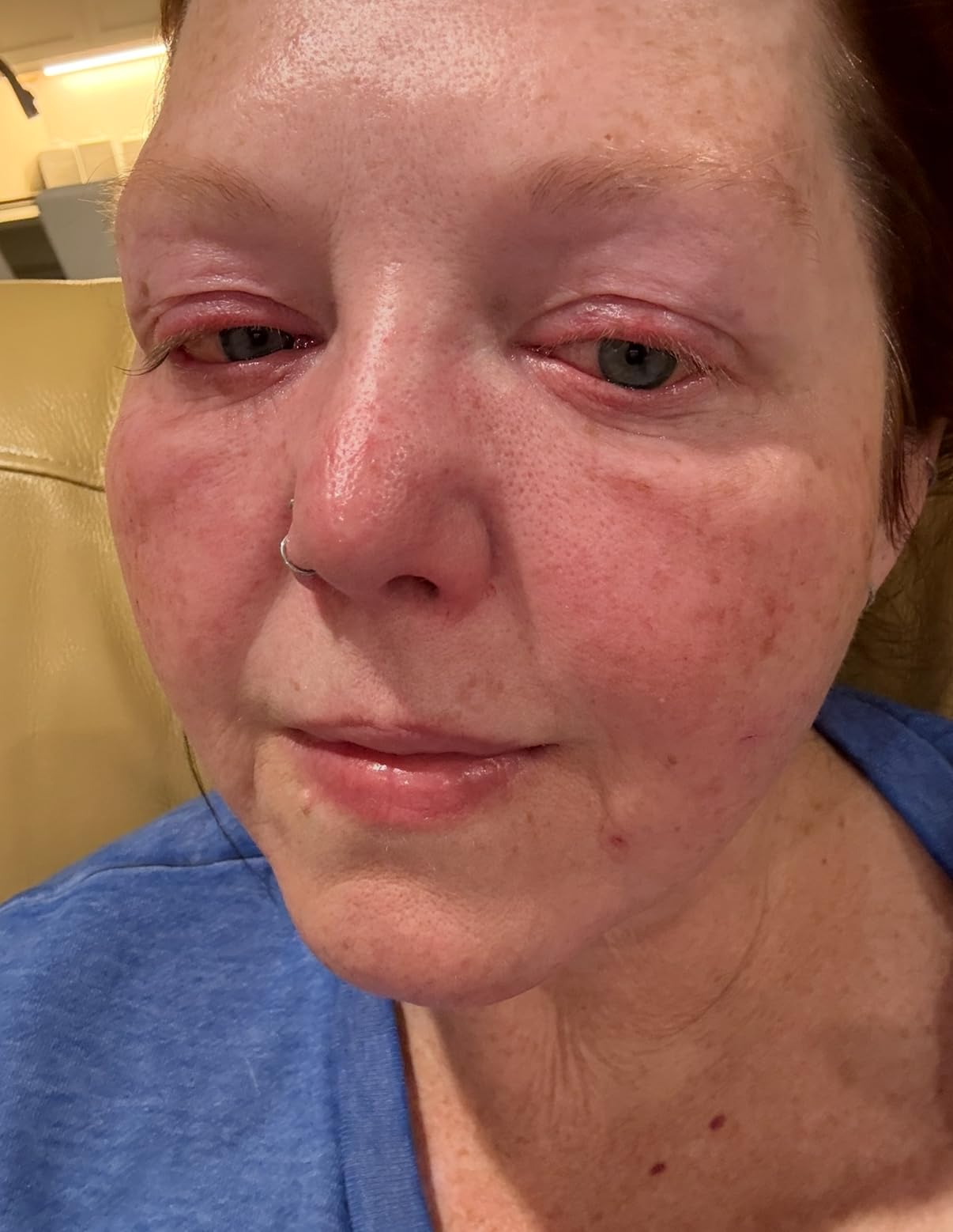 medicube Booster Pro | 6-in-1 Real Glass Glow Beauty Massager | for Clear, Radiant, Firmer-Looking Skin | Korean Skin Care | Pink customer photo 1