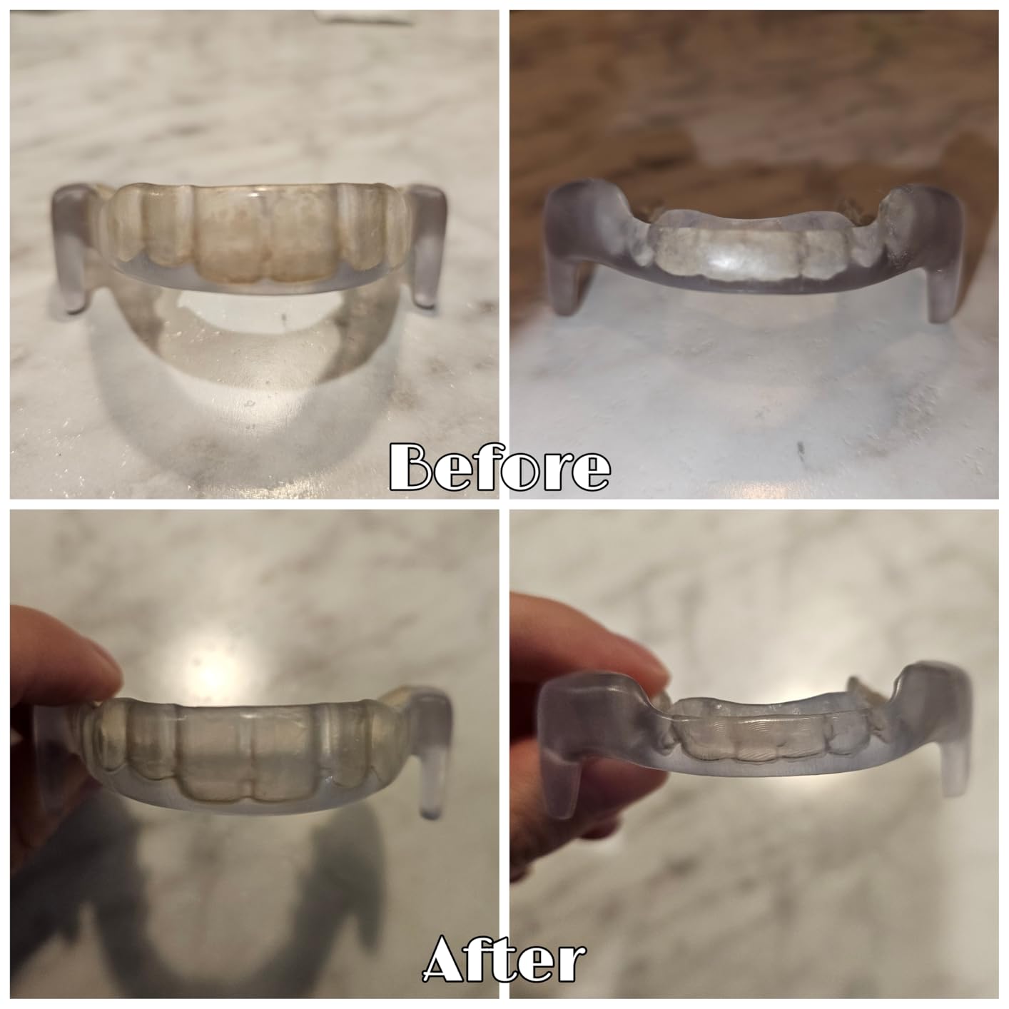 Dental Ultrasonic Retainer Cleaner Machine: 45kHz Dental Cleaning Pod with Digital Timer & 200ML, Deep Cleaning for Dentures, Mouth Guards, Aligners, Night Guards, Braces, Toothbrush Heads & Jewelry customer photo 1