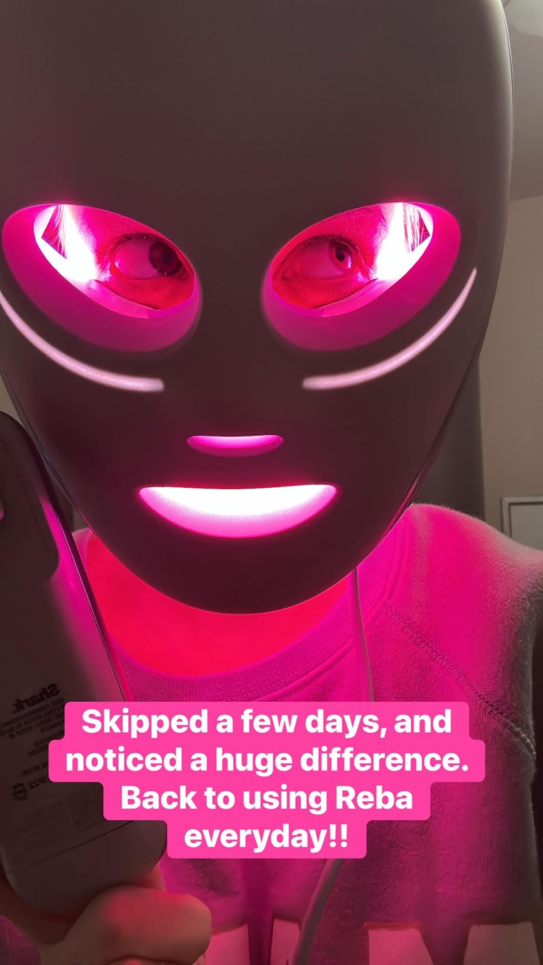 Shark CryoGlow LED Face Mask with Under-Eye Cooling, Anti-Ageing & Blemish Repair, Red & Blue LED, Infrared Light Therapy, USB-C, Remote Control, Storage Bag, Blue Frost, FW312 customer photo 1