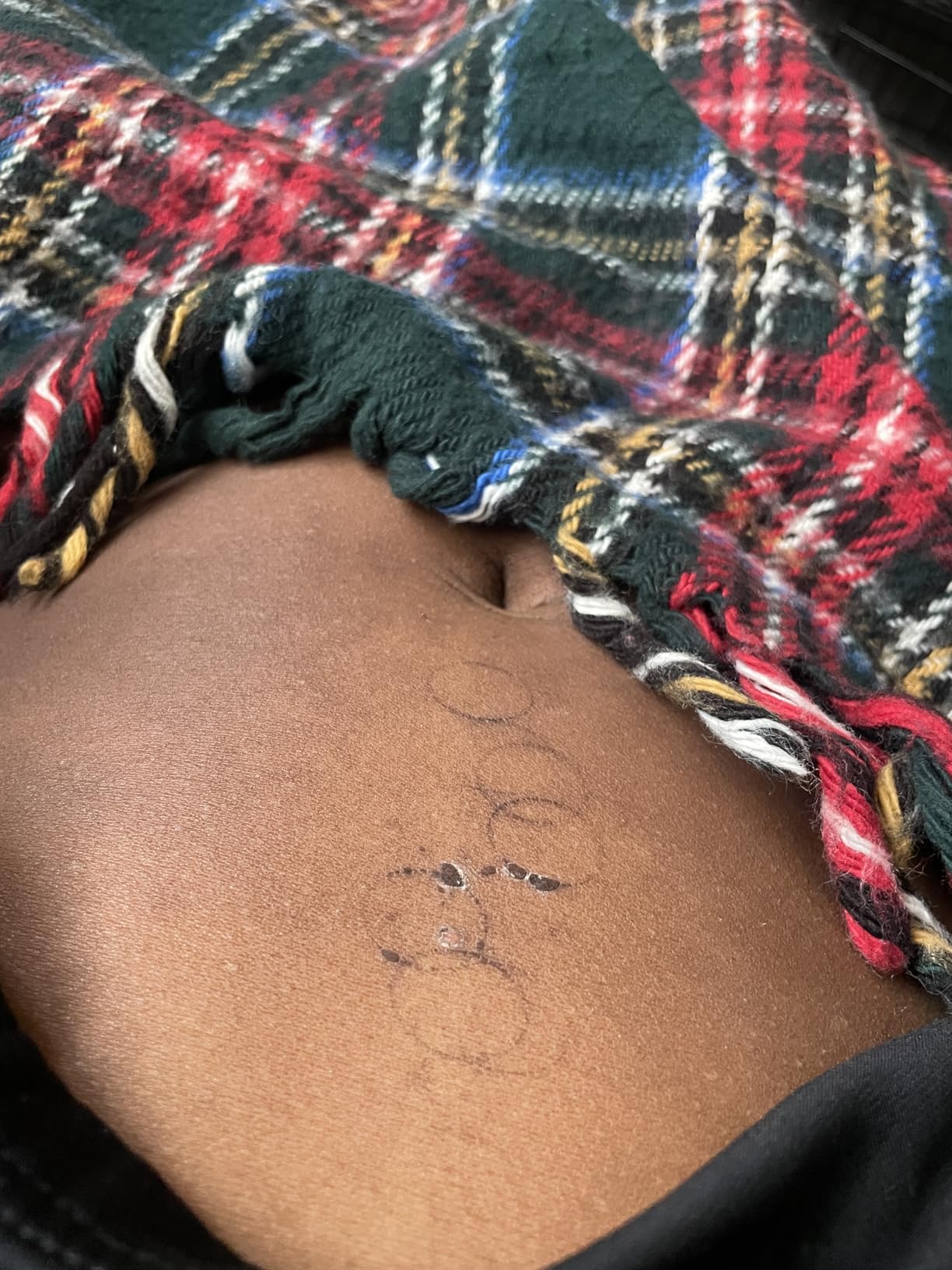 2 Pack Smart Cupping Therapy Massager, 5-in-1 Cupping Therapy Set for Pain Relief, Knots, Aches, Muscle Soreness, Electric Cupping kit for Massage Therapy with Remote Control customer photo 2