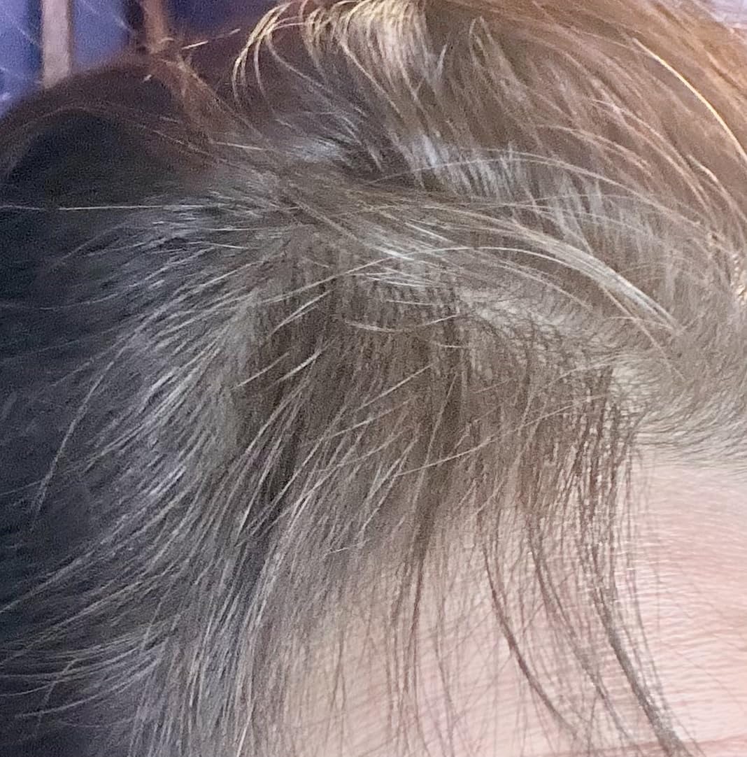 Laser Hair Growth Cap, Red Light Therapy for Hair, Deep Black Cap customer photo 1