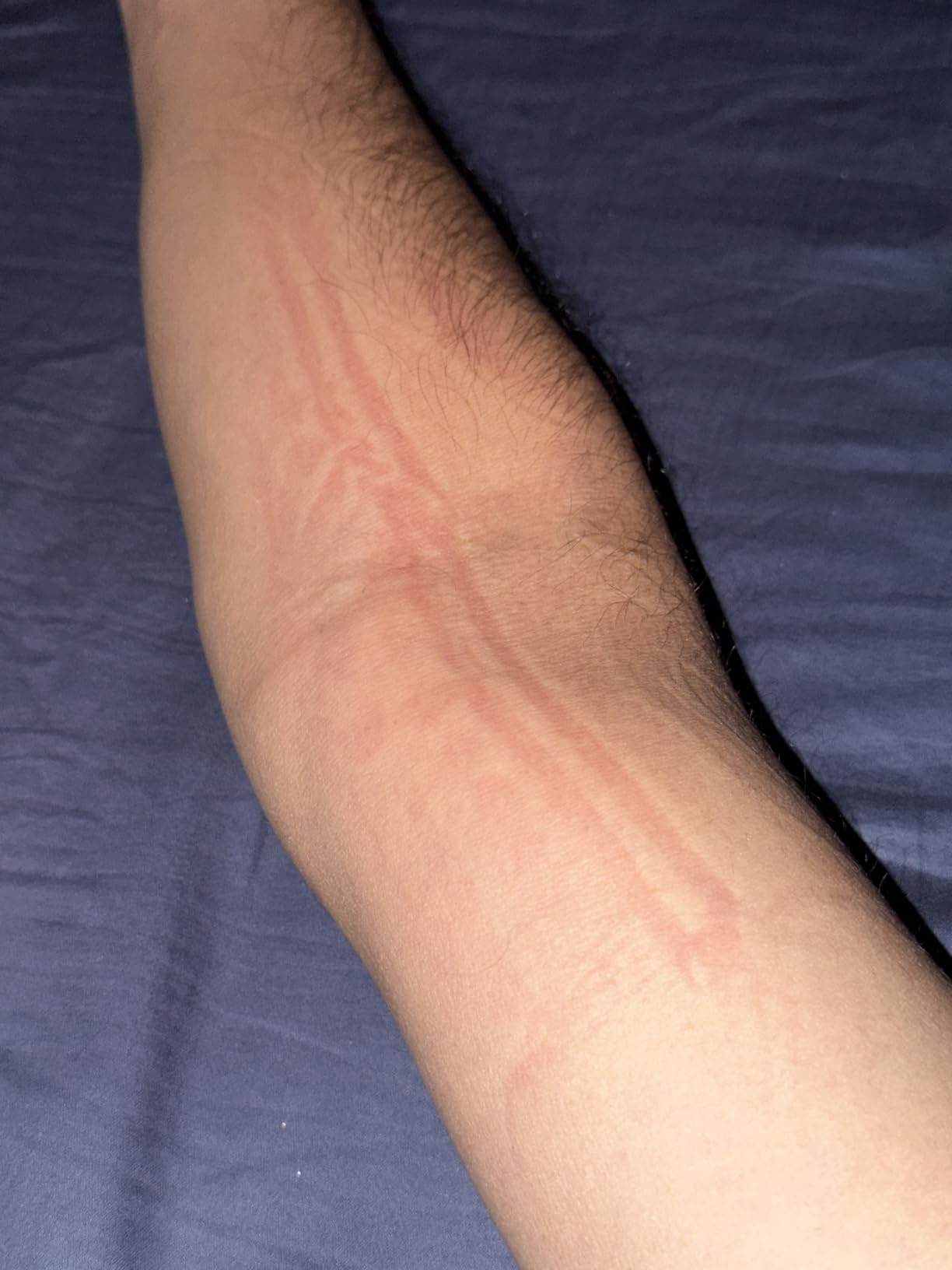 Garmin Index Sleep Monitor customer photo 1