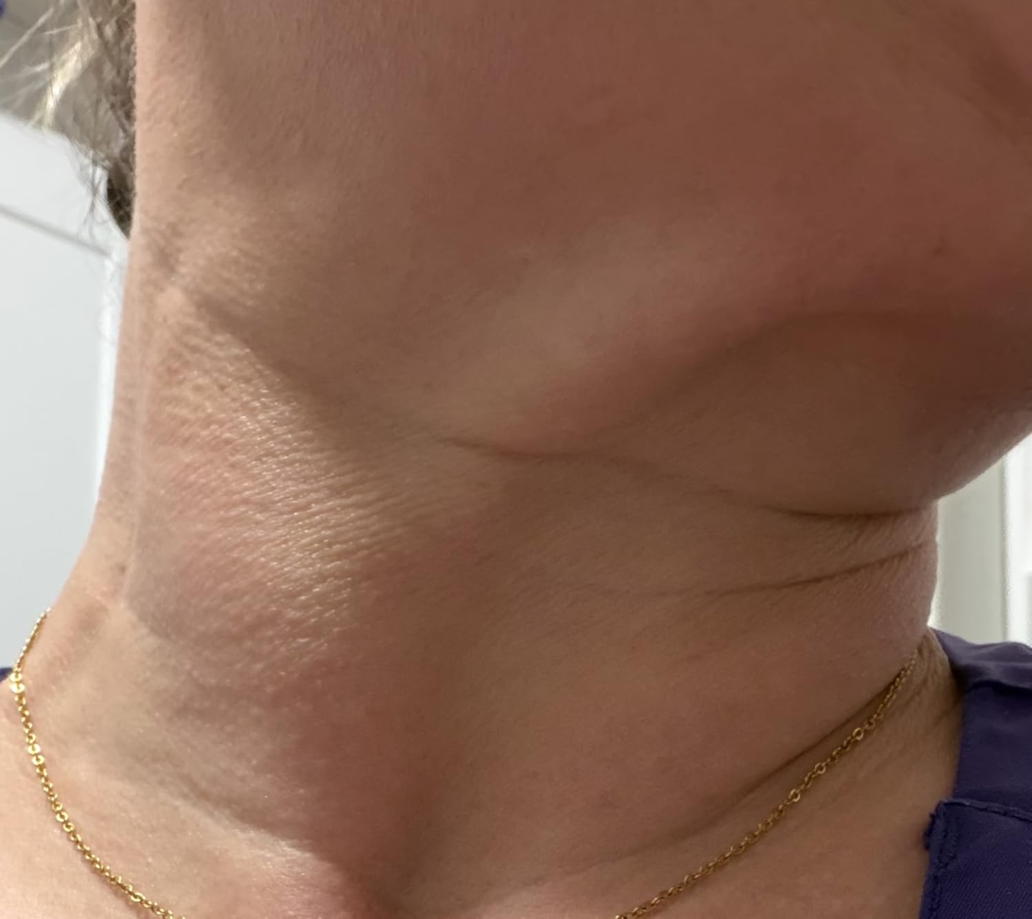 INIA 7-in-1 Red Light Therapy for Face and Neck Gua Sha Facial Massager Tool Device with Thermal and Cryo Mode for Puffiness & Firming Skincare Tool customer photo 1