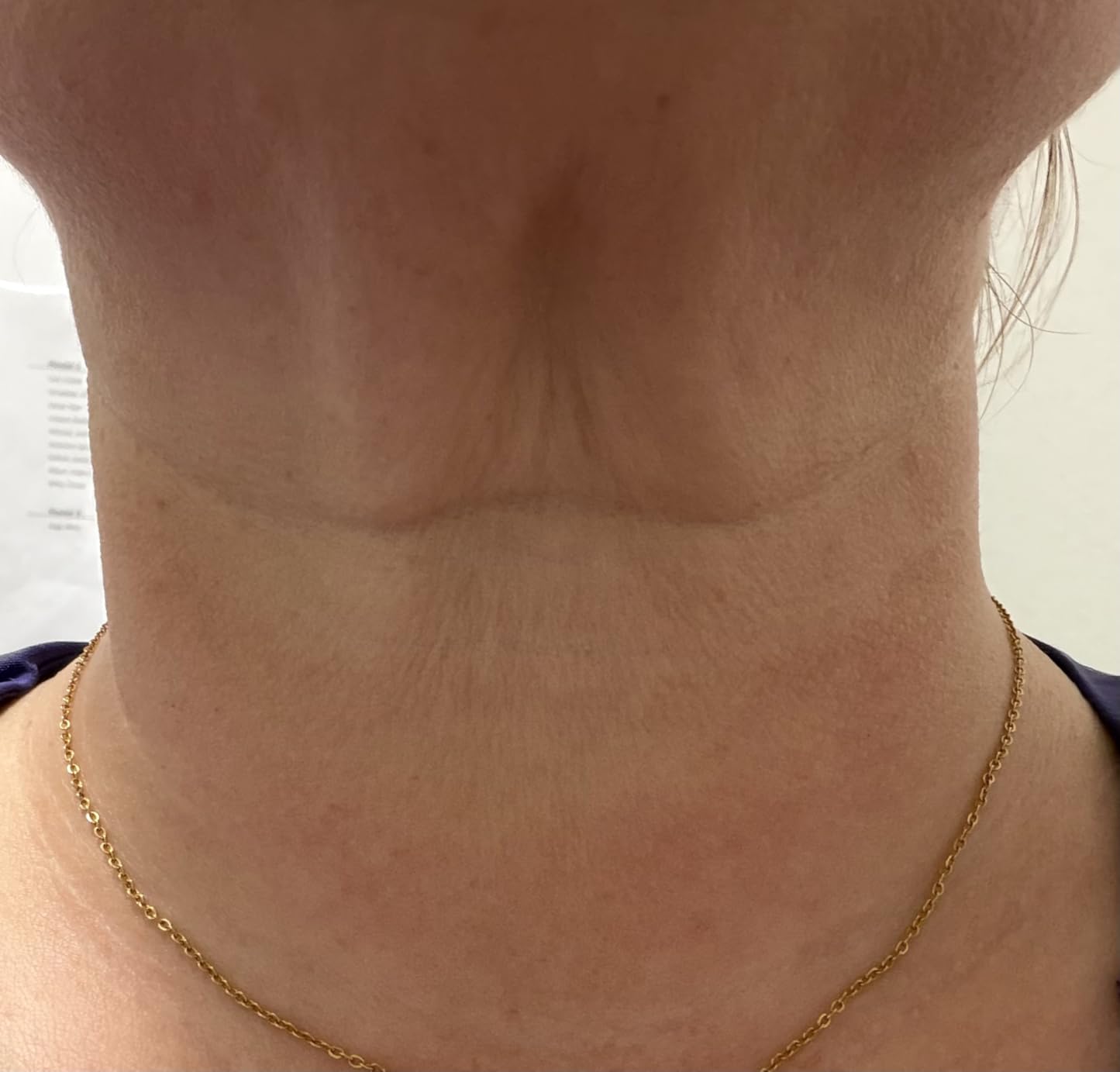 INIA 7-in-1 Red Light Therapy for Face and Neck Gua Sha Facial Massager Tool Device with Thermal and Cryo Mode for Puffiness & Firming Skincare Tool customer photo 2