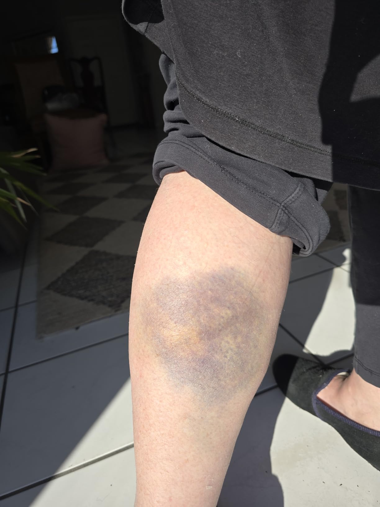 Paiseec S3 Pro Mobility Scooters for Adults, 40 Miles Long Lasting Mobility Scooter, Lightweight Travel Scooter for Seniors, 300 lbs Capacity, AI Speed Control, 250W Motor (Grey-40miles-S3) customer photo 1