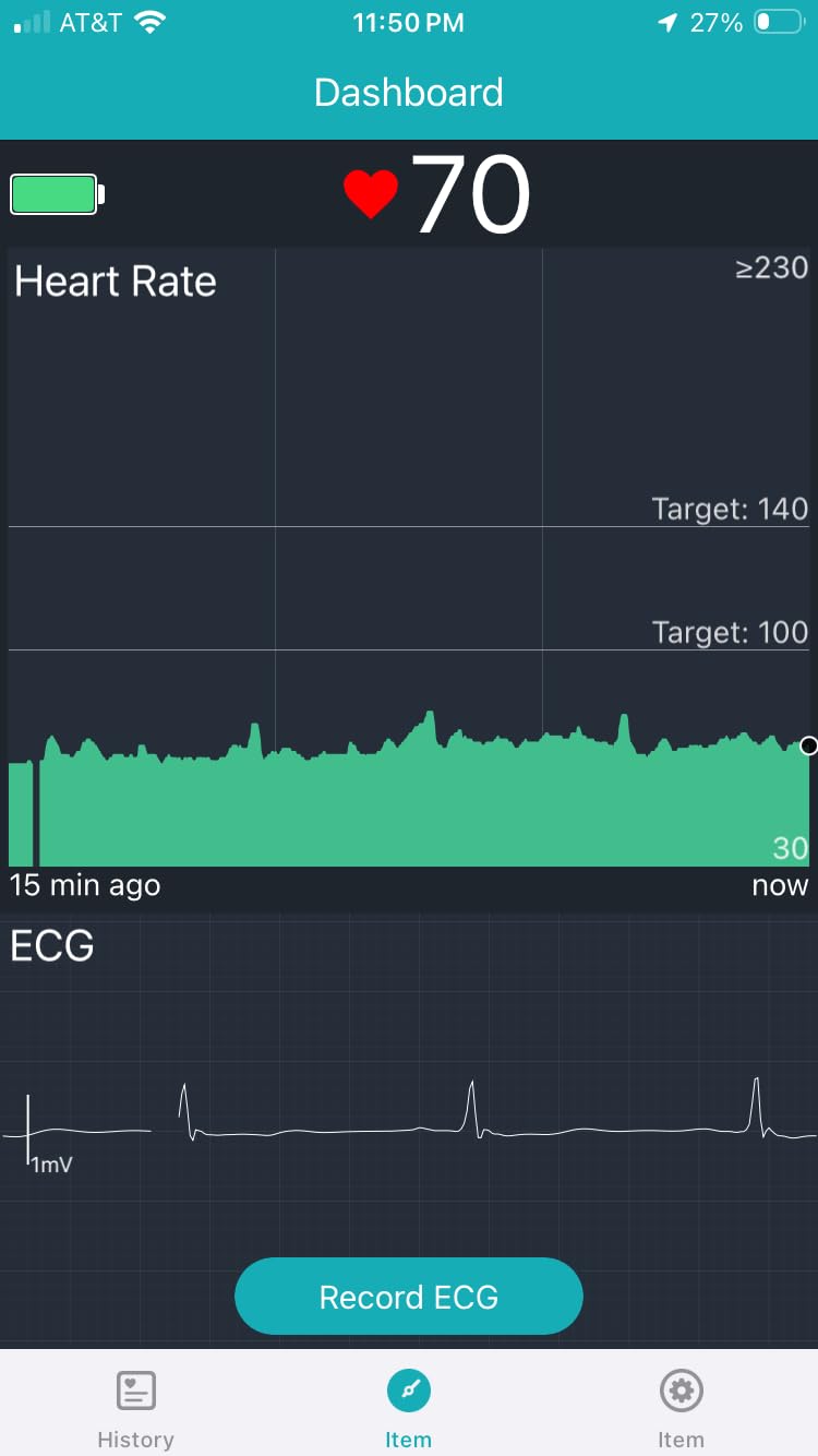 1-Lead Heart Health Monitor at Home, Portable 24 Hours Chest Lead Device with Free AI Analysis & PC Report, Rechargeable Recorder, HHM1 customer photo 1