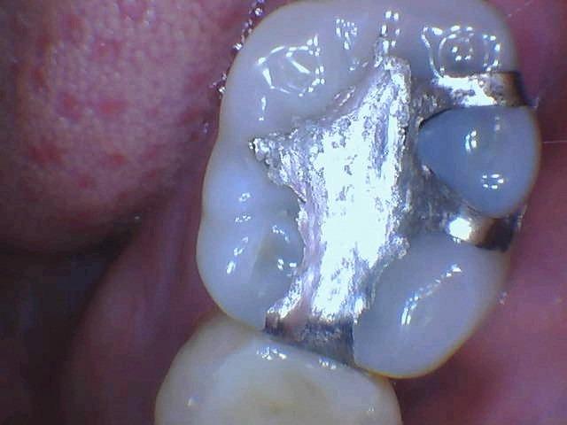 DY-50 Intraoral Camera Dental Camera Super Clear Button Driver Included Work W/Eaglesoft Dexis More customer photo 2