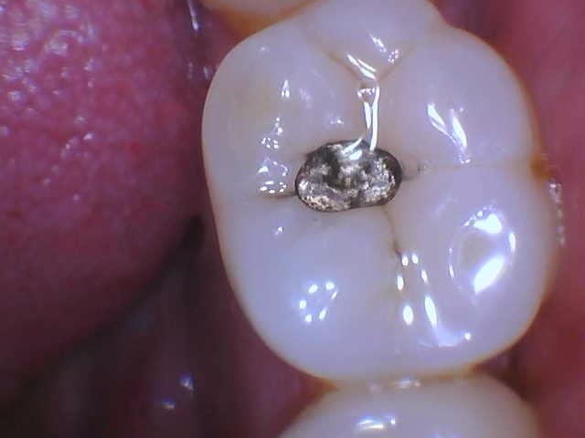 ProDENT Intraoral Camera PD740, Capture Button Driver to Work with Eaglesoft, Dexis, Apeteryx, Carestream, Tigerview customer photo 2