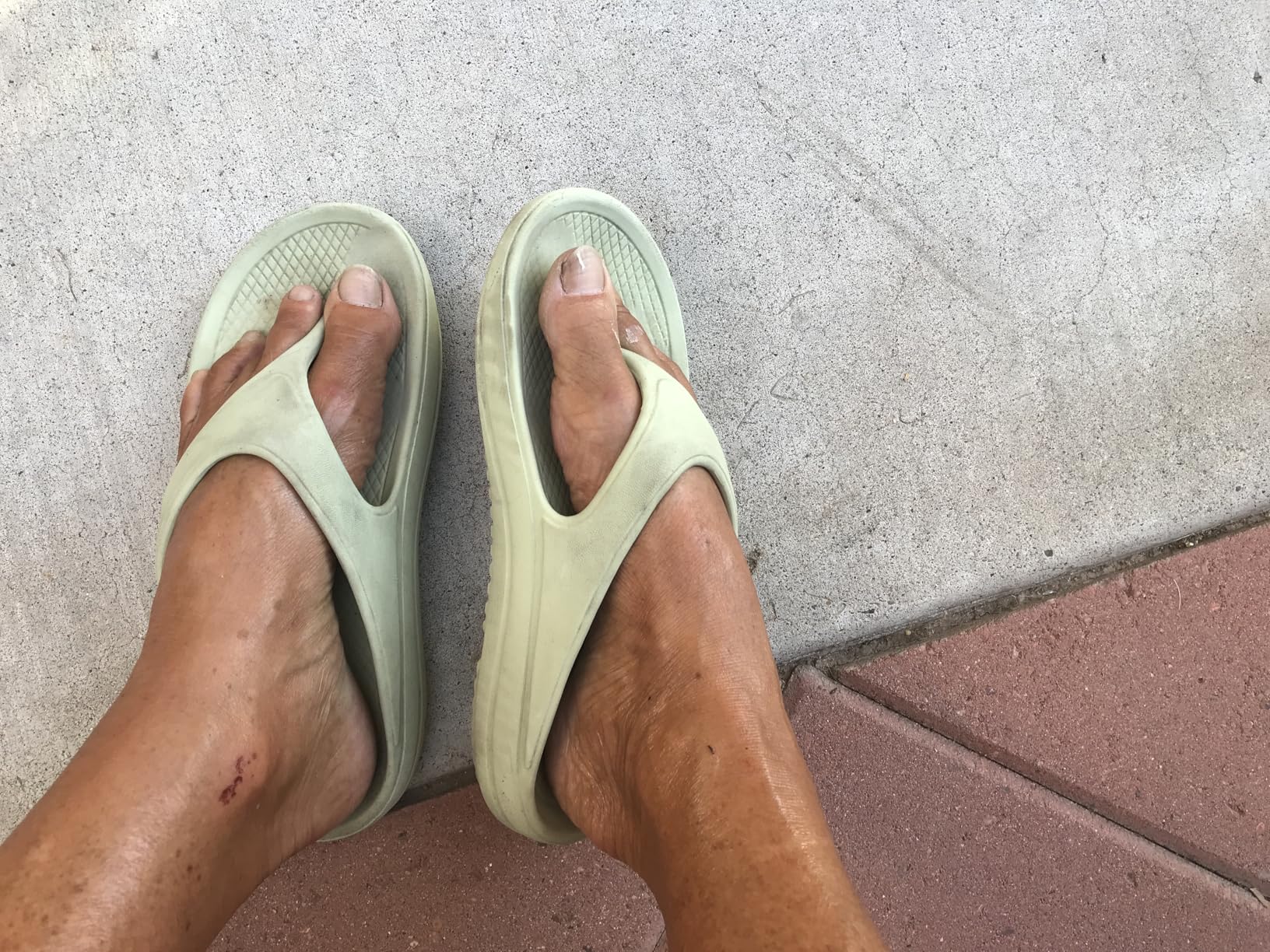 shevalues Orthopedic Sandals for Women Arch Support Recovery Flip Flops Pillow Soft Summer Beach Shoes customer photo 2