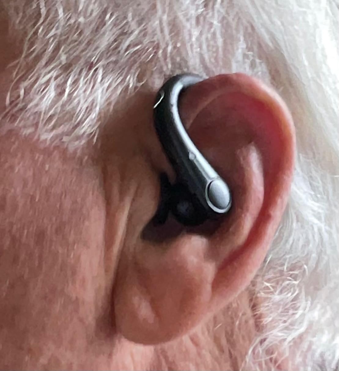 Hearing Aids for Seniors, Hearing Aids Rechargeable with Bluetooth, Hearing Aid APP Control, Hearing Amplifier for the Hearing Loss, Hearing Your Voice customer photo 1
