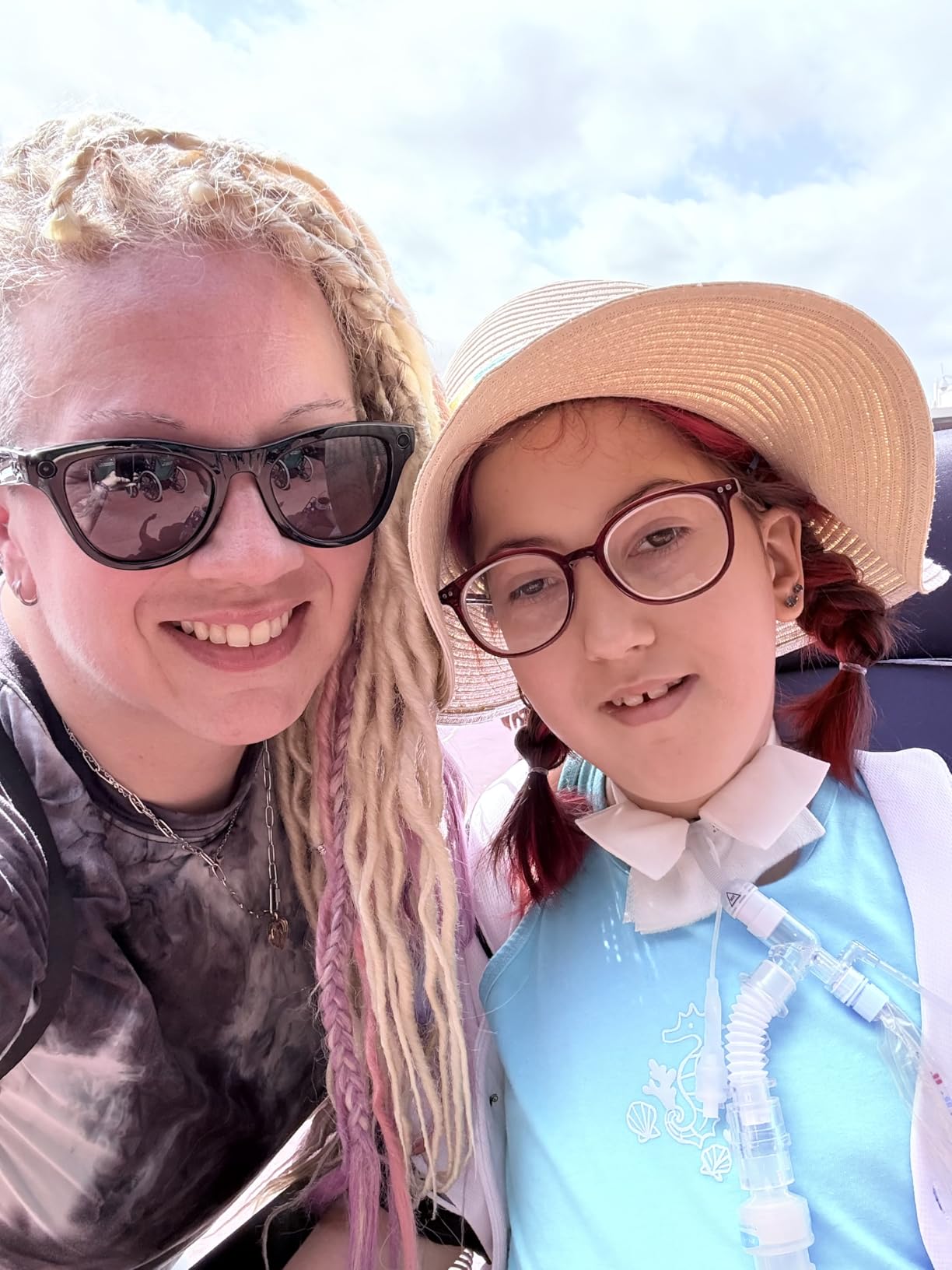 Ray-Ban Meta (Gen 2), Skyler, Shiny Black | Smart AI Glasses for Men, Women - 2x Battery Life - 3K Ultra HD Resolution - 12 MP Ultra-Wide Camera, Audio, Video - Green Lenses - Wearable Technology customer photo 1