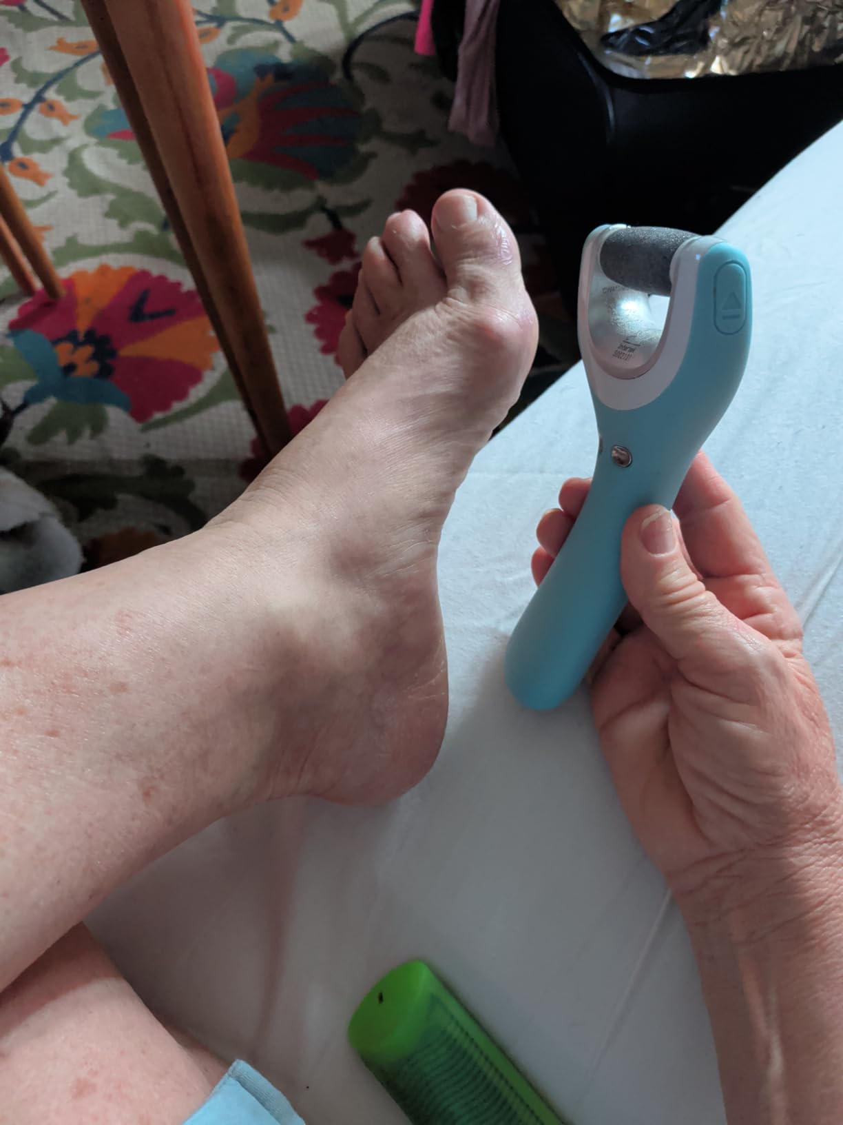 Amope Pedi Perfect Pro Wet & Dry Electric Foot File Callus Remover Kit, Waterproof, Rechargeable, Pedicure Tool for Feet, Removes Hard, Dead Skin, Feet Scrubber w/ Diamond Crystals, w/ 3 Roller Heads customer photo 2