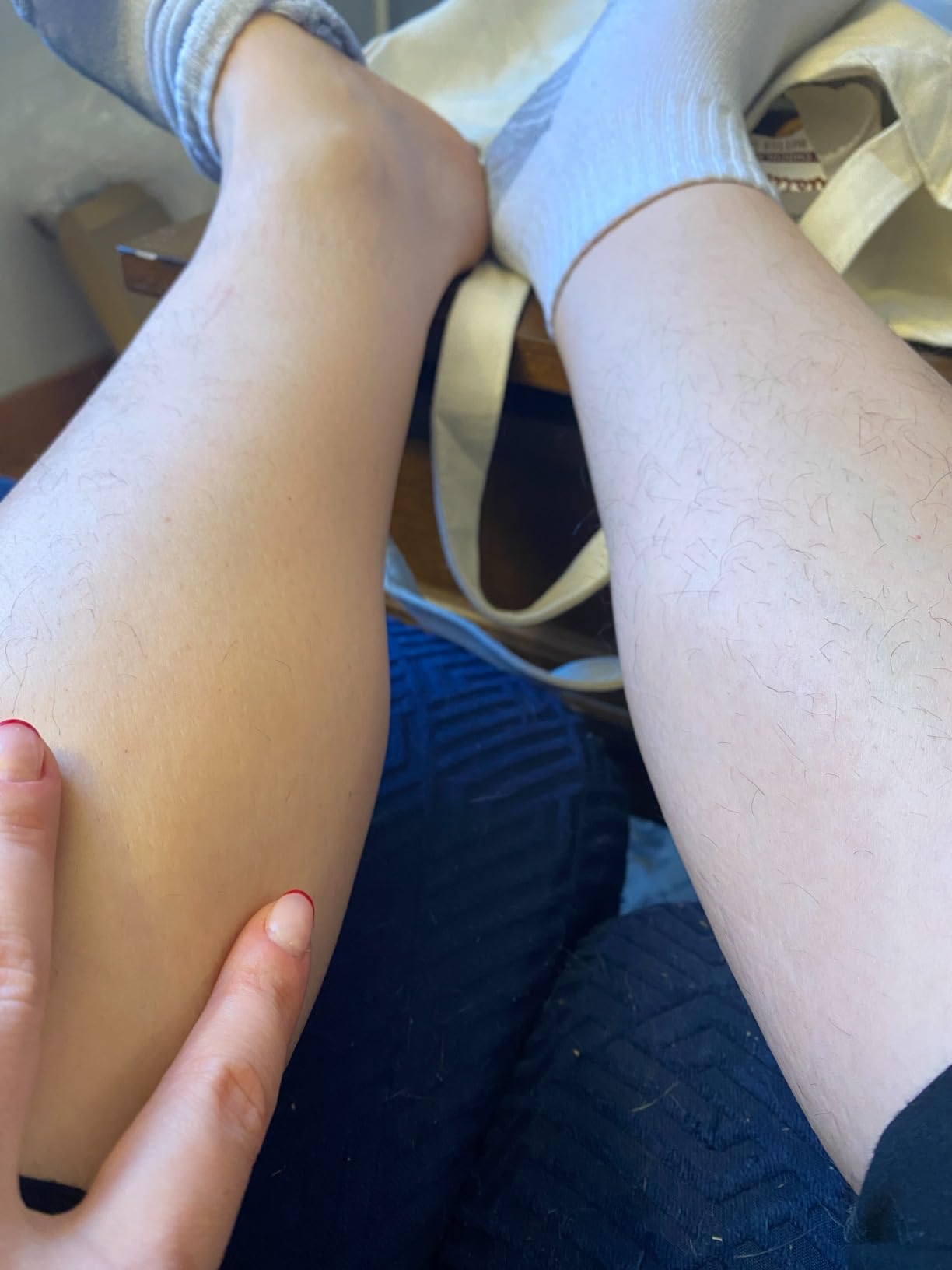 JOVS Laser Hair Removal, IPL with 37F Sapphire Ice-Cooling Tech, 6 Modes, 330 Rotation customer photo 1