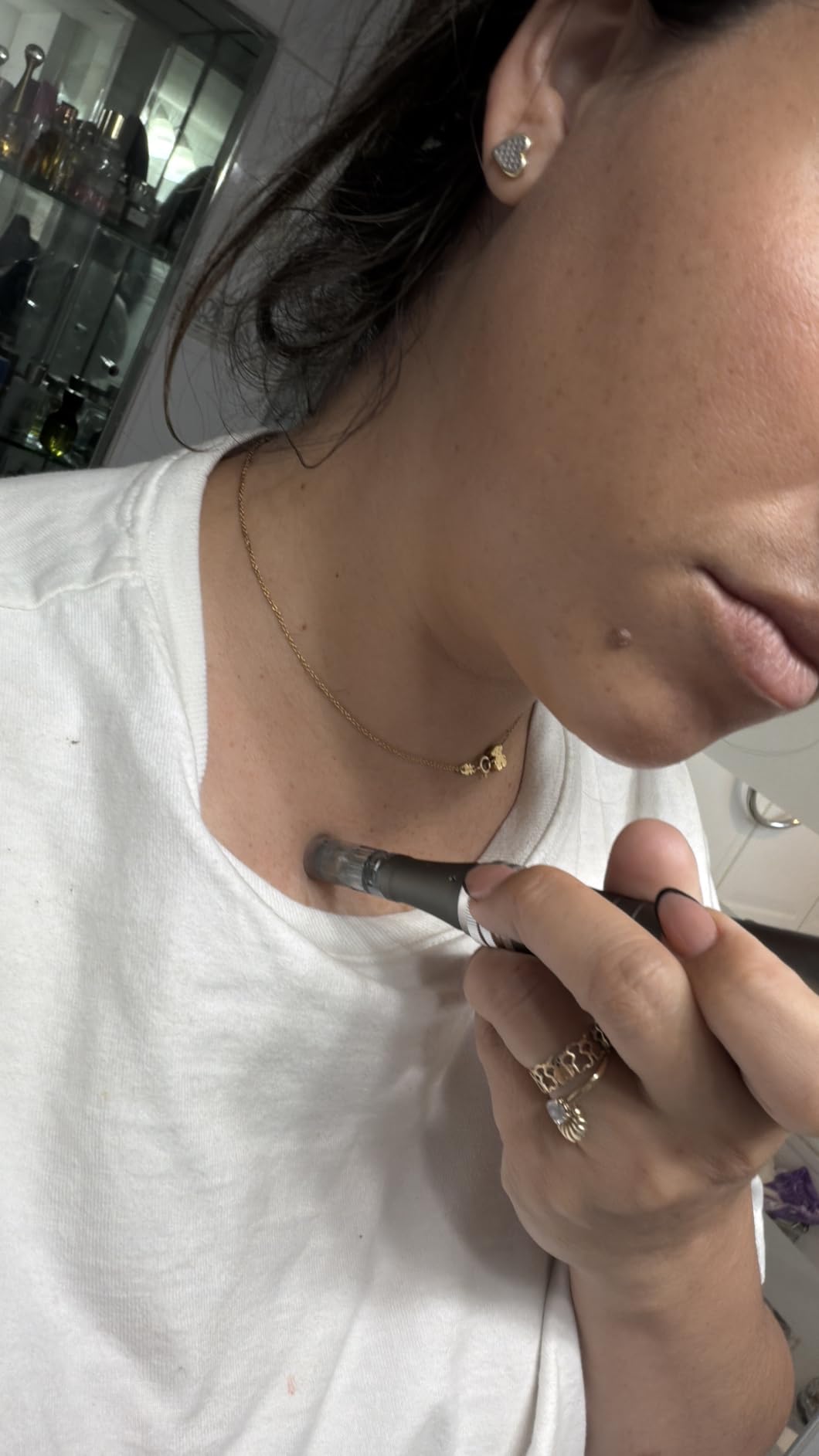 DermaStamp System 0.25mm, Microneedling Stamp Pen, Derma Stamp Pen, Derma Roller Alternative customer photo 2