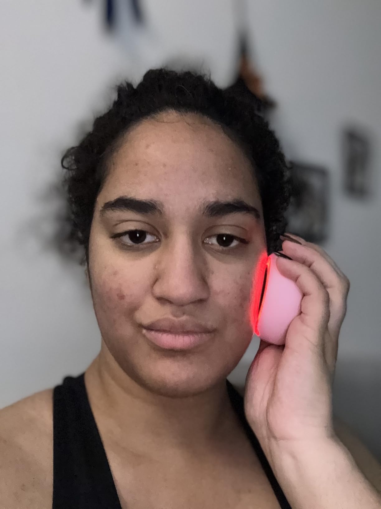 FOREO UFO 2 Supercharged Face Mask - Warming - Face Moisturizer - Dark Spot Treatment customer photo 1