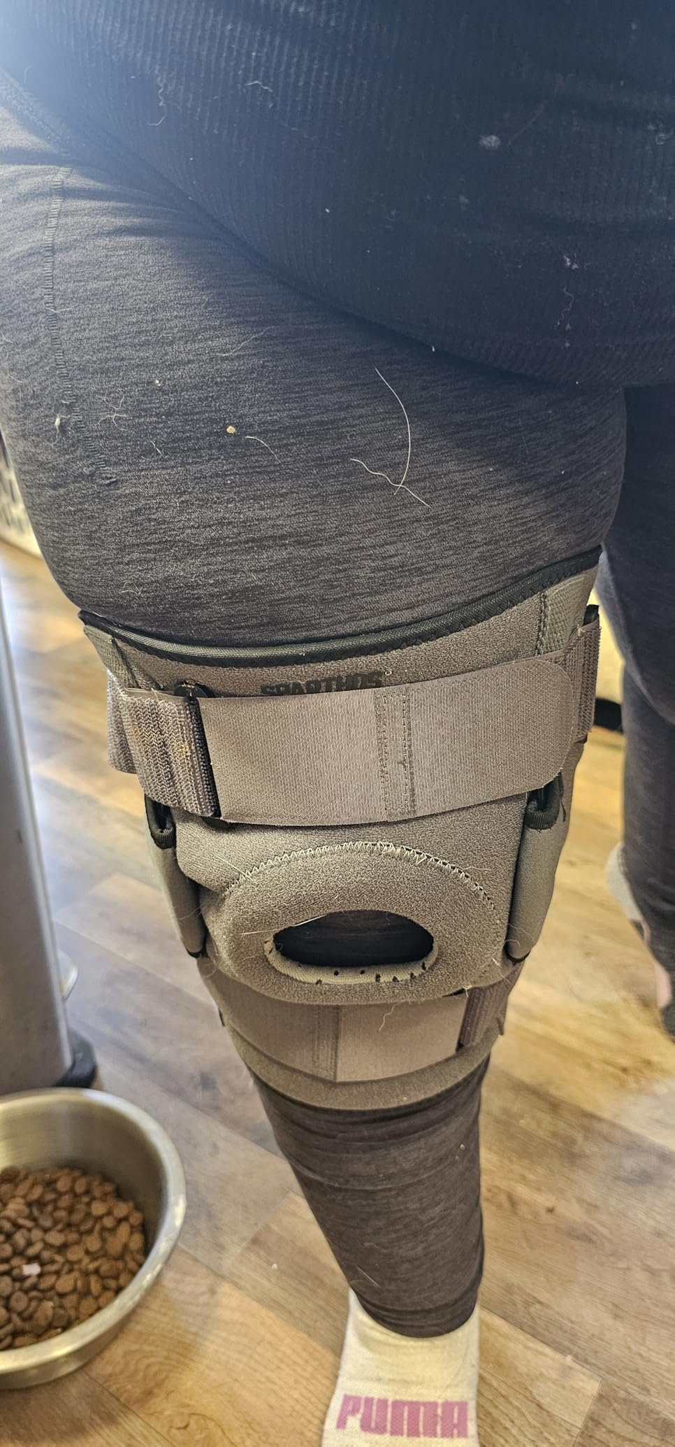 Sparthos Knee Brace for Women & Men - Meniscus Tear Support - Hinged Metal Side Stabilizers, Adjustable Compression Straps, ACL MCL Arthritis Pain Relief, Open Patella, Running & Sports customer photo 1