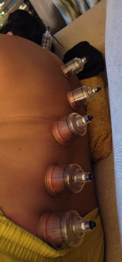 KS Premium Quality Cupping Set w/ 19 Cups - BEST CUPPING SET IN KOREA customer photo 1