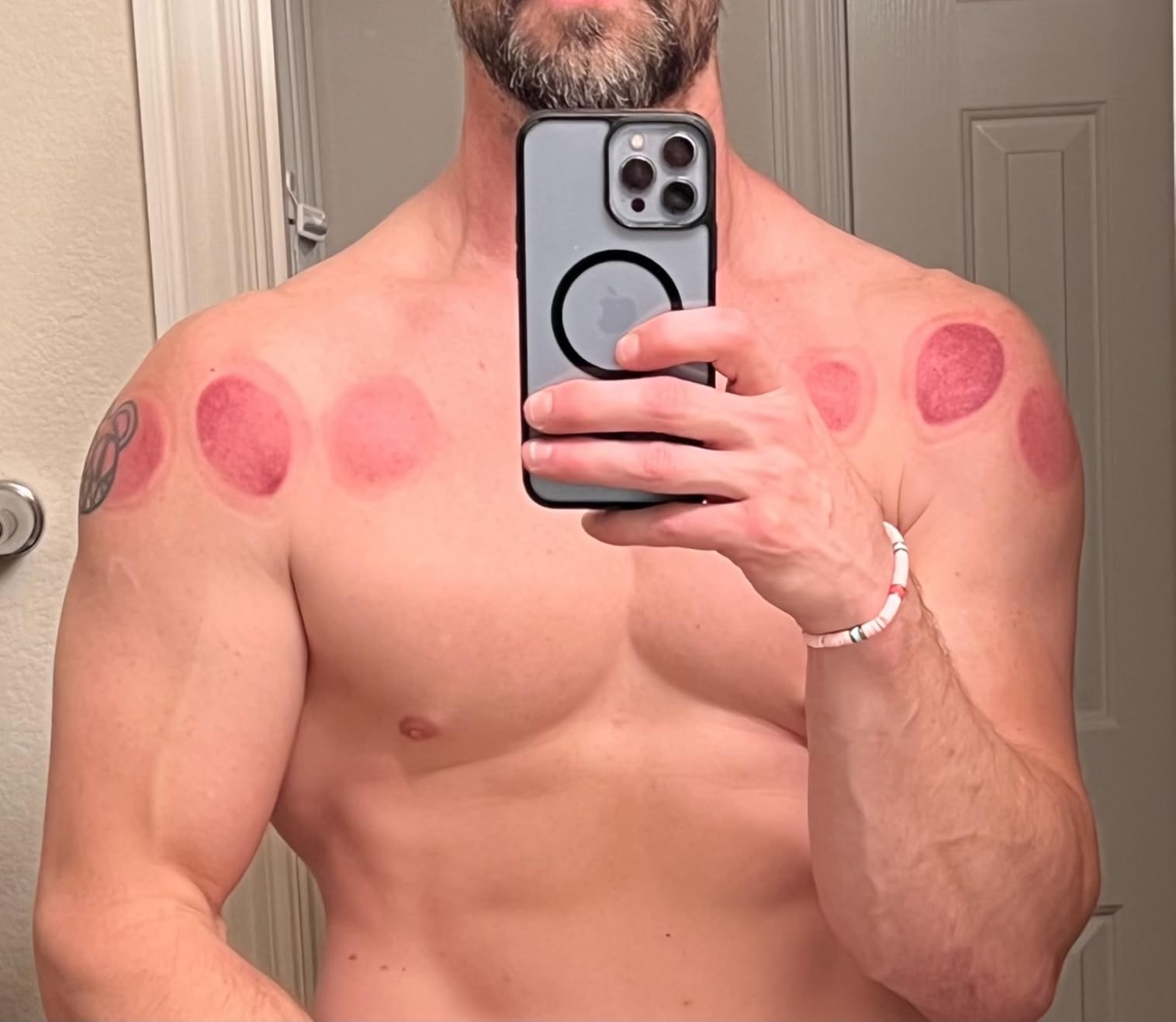 KS Premium Quality Cupping Set w/ 19 Cups - BEST CUPPING SET IN KOREA customer photo 2