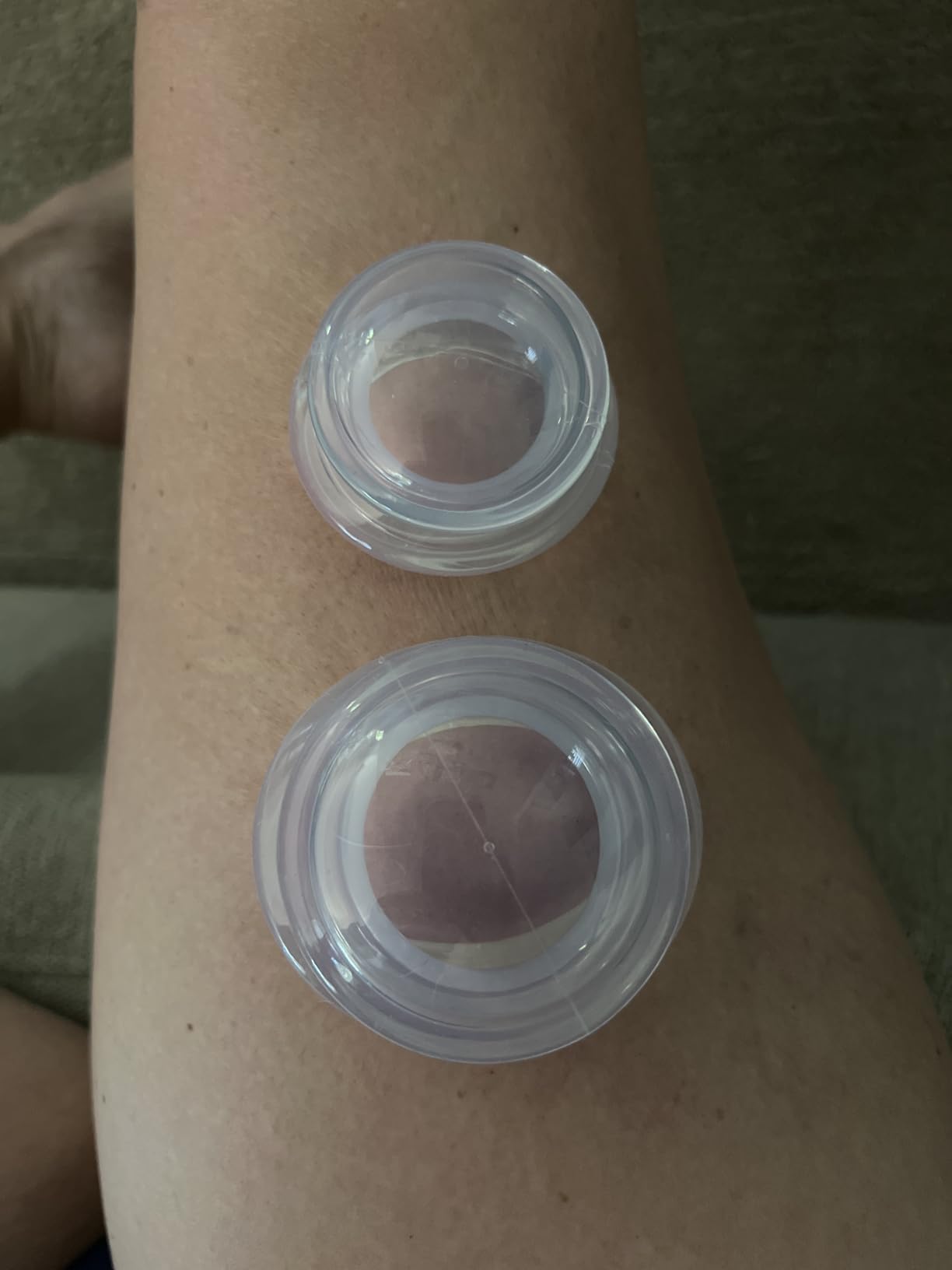 ELERA Silicone Cupping Therapy Set, Professionally Chinese Massage Cups for Cupping Therapy and Cellulite Reduction (7 Cups) customer photo 1