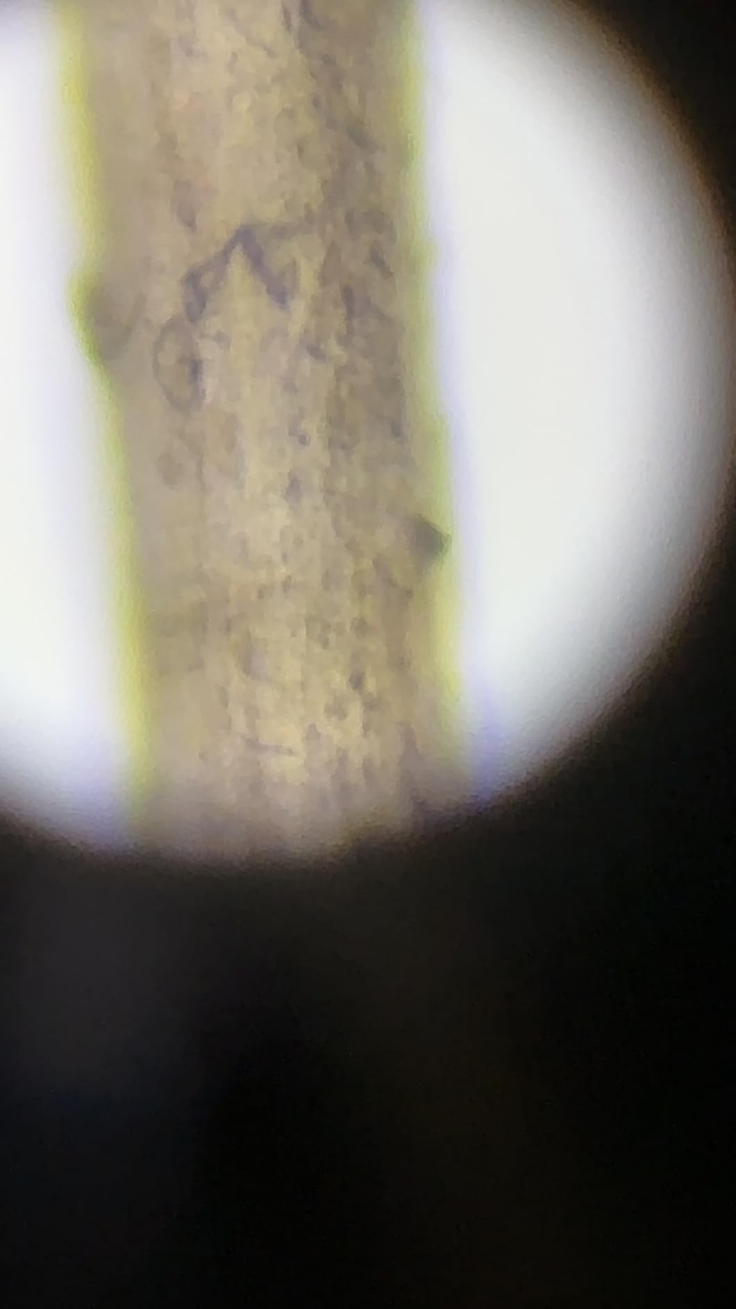 Swift SW380T 40X-2500X Magnification, Siedentopf Head, Research-Grade Trinocular Microscope Compound Lab with Wide-Field 10X/25X Eyepieces, Mechanical Stage, Ultra-Precise Focusing, Camera-Compatible customer photo 1