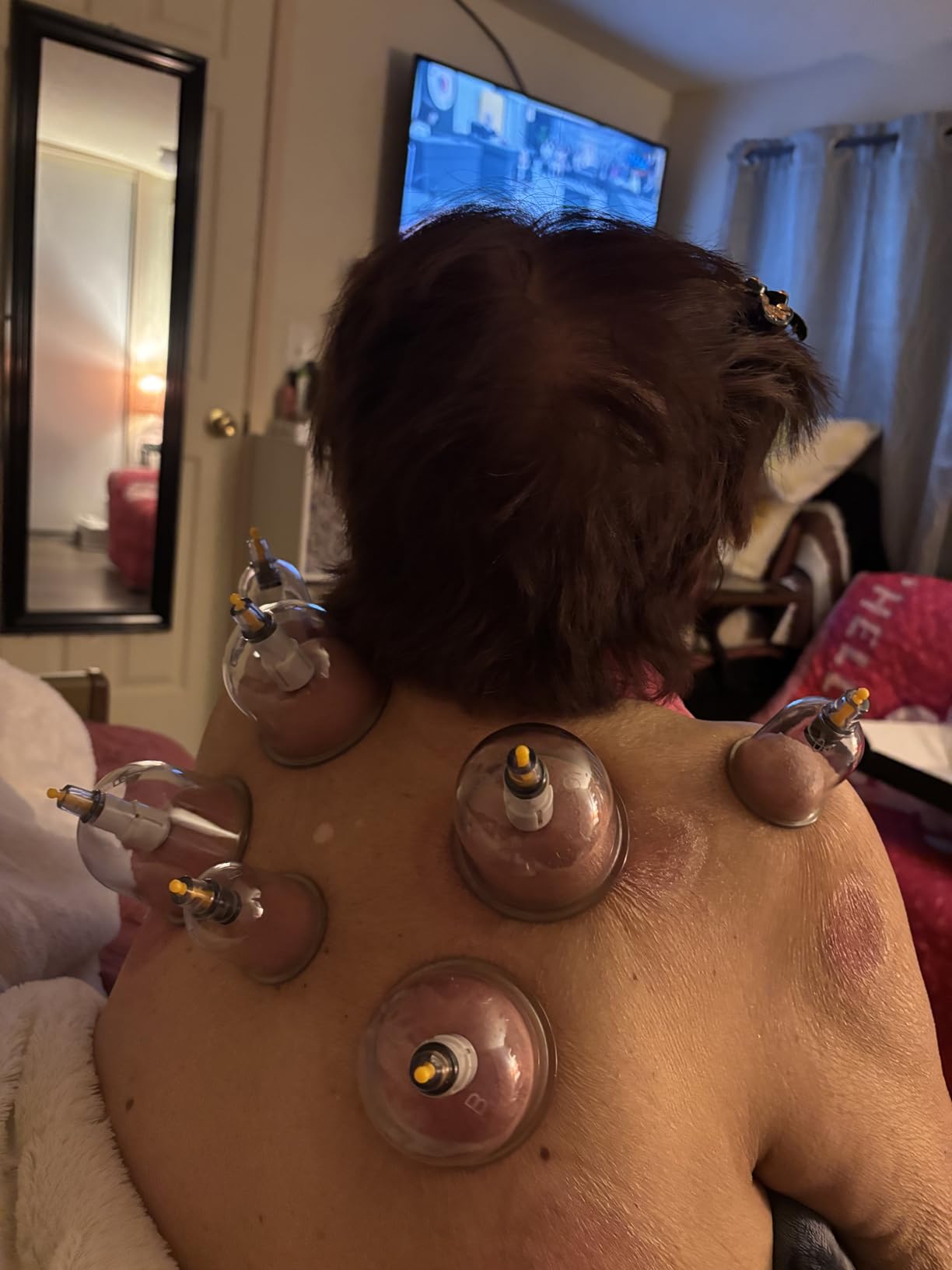 MUCHOO Cupping Set Professional Chinese Acupoint Cupping Therapy Sets Portable, Suction Hijama Cupping Set with Vacuum Magnetic Pump Cellulite Cupping Massage Kit 22-Cup customer photo 1